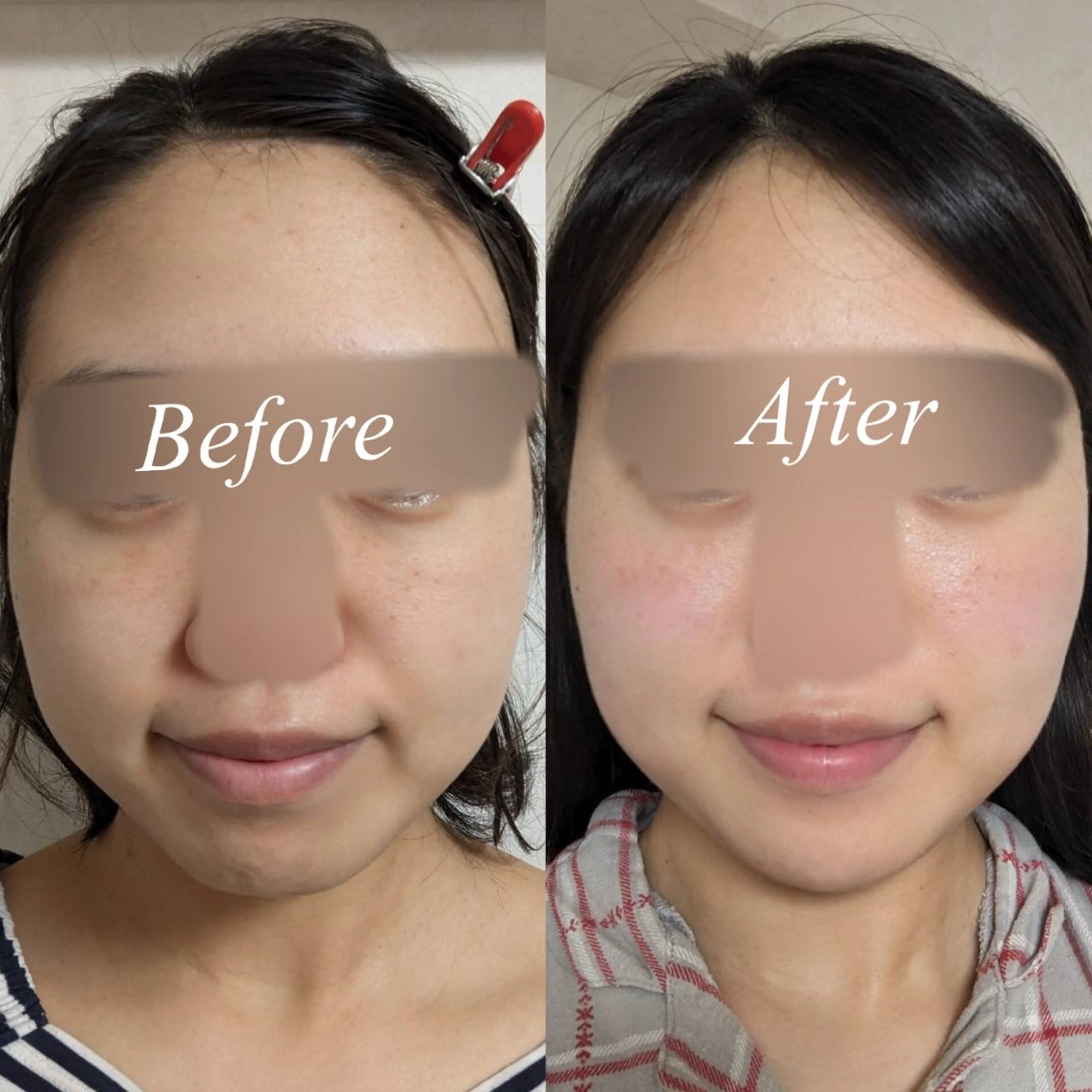 肌質改善サロン🌕 ⠀【ルーナピエナ】のエステ・リラクイメージ