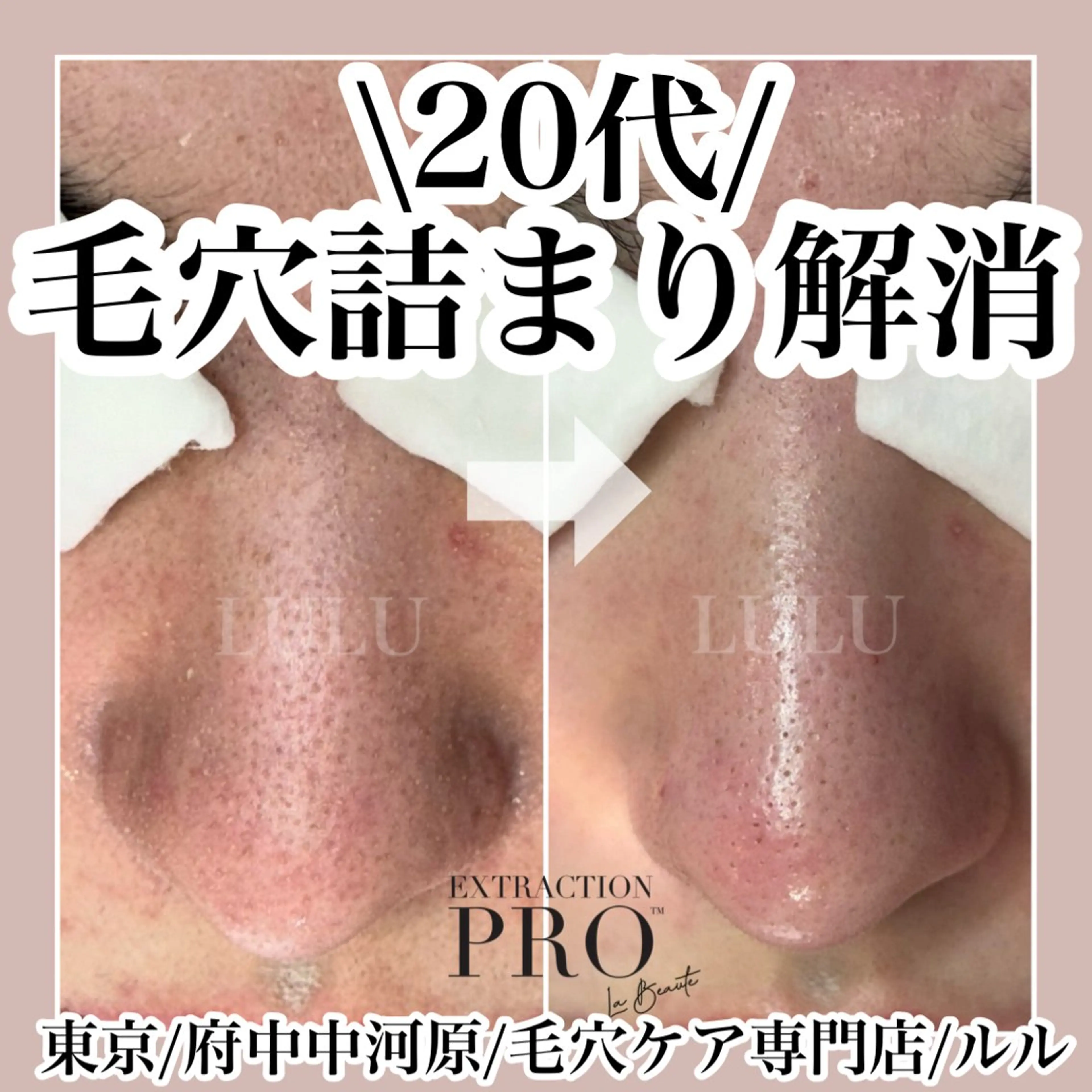 エステ LULU所属・LULU ルルのエステ・リラクイメージ