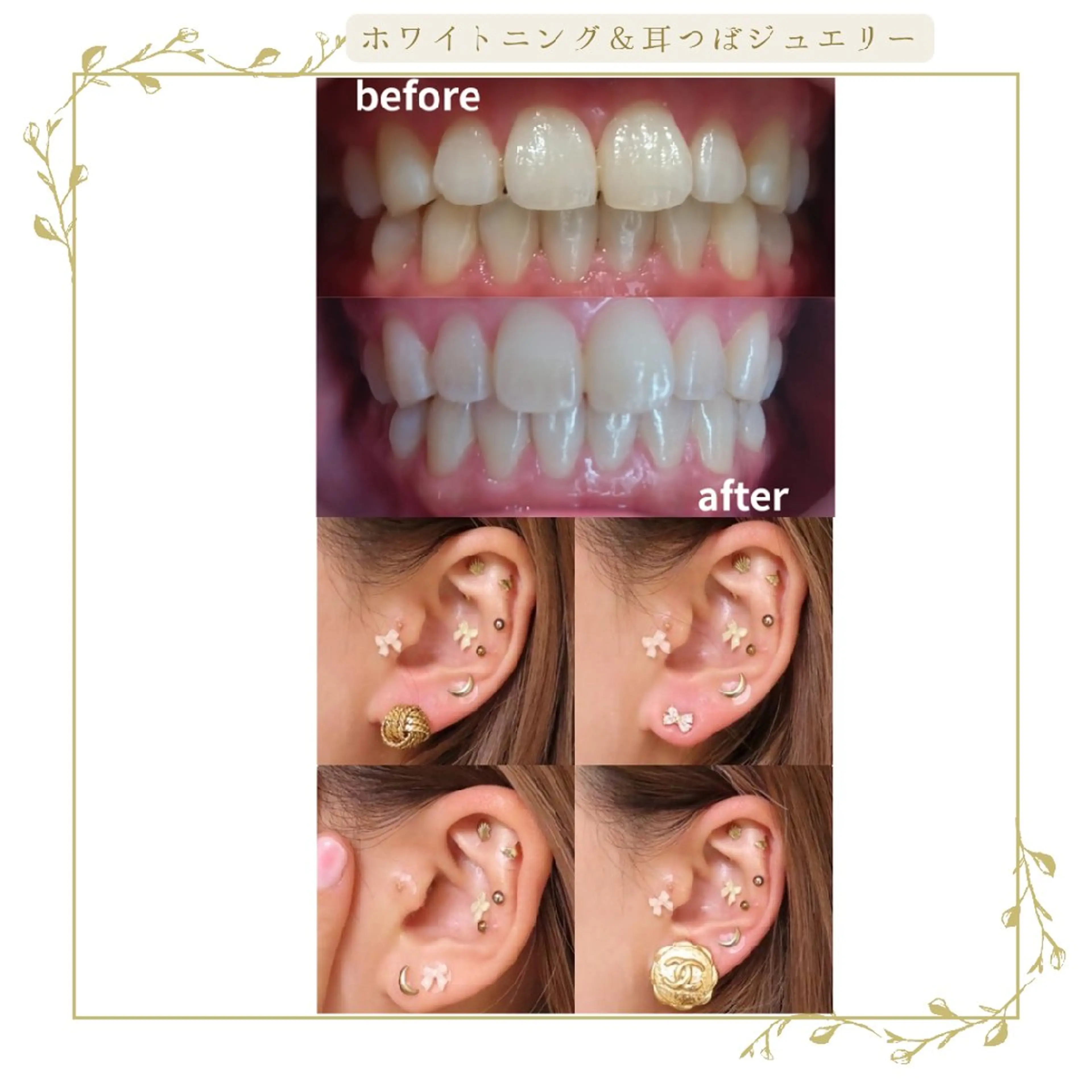 coco whitening＆Beauty所属・阿部 香織のエステ・リラクイメージ