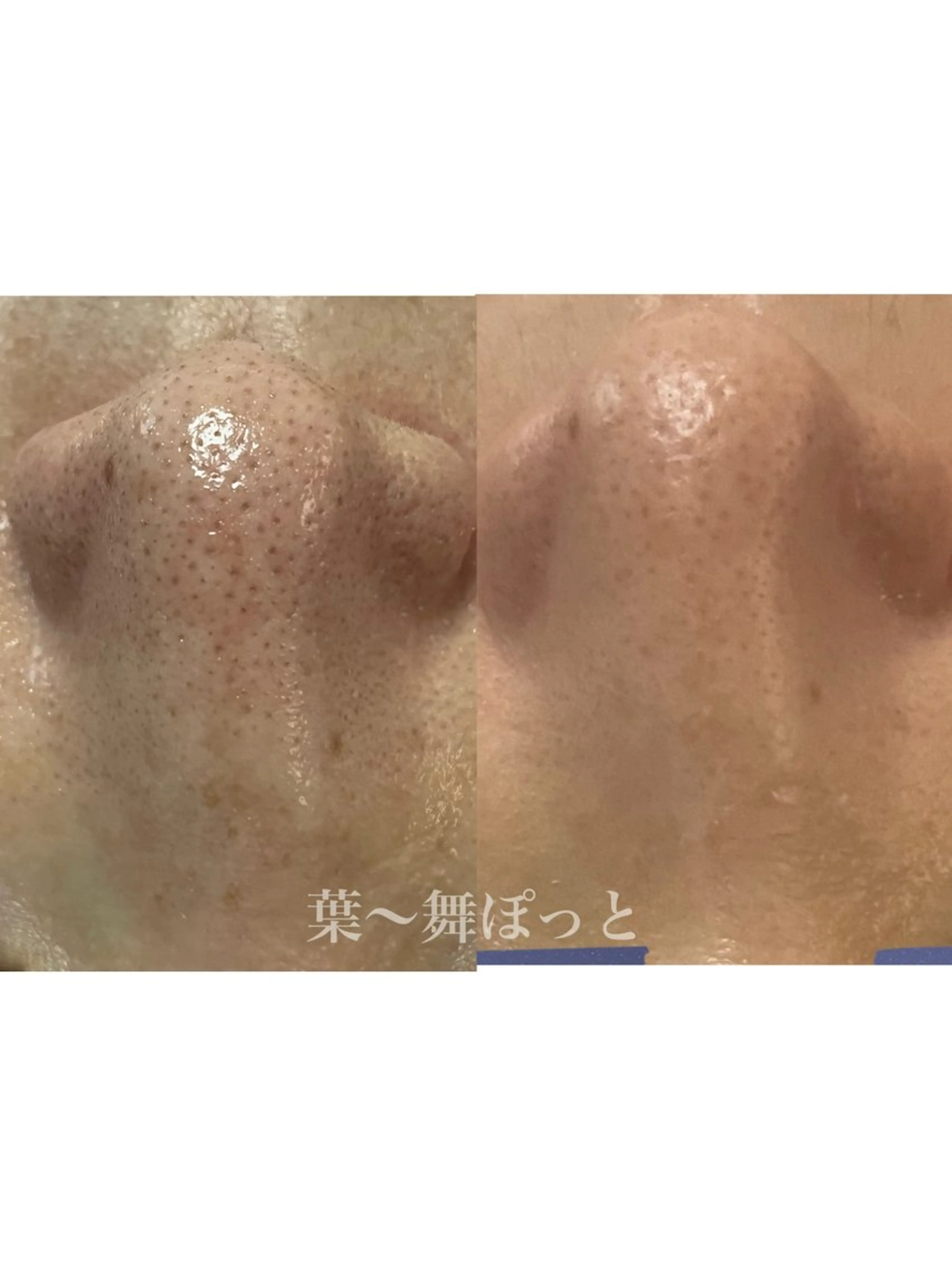 うえつま ふみえのエステ・リラクイメージ