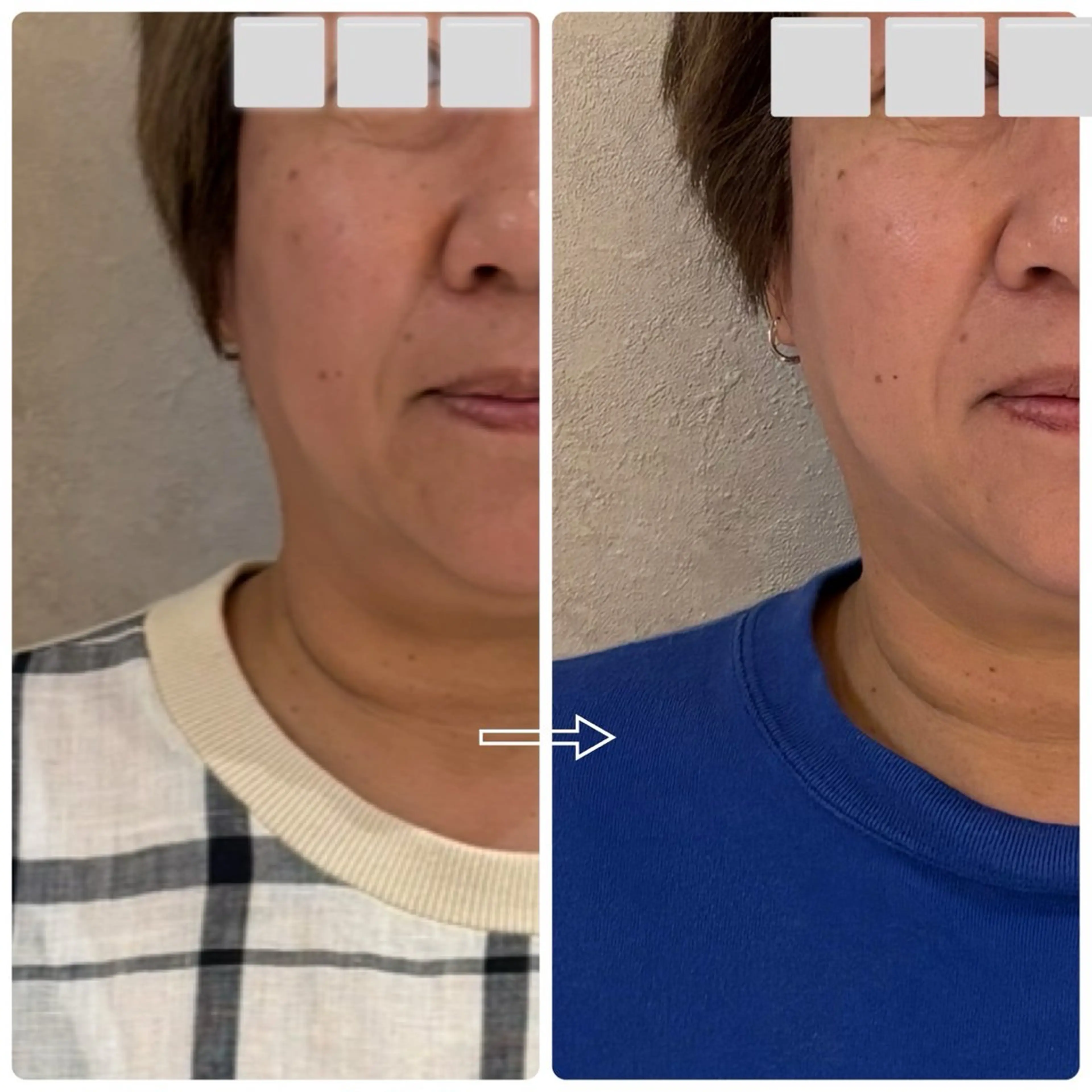 private salon.ohana所属・小顔/ララピール ohanaのエステ・リラクイメージ