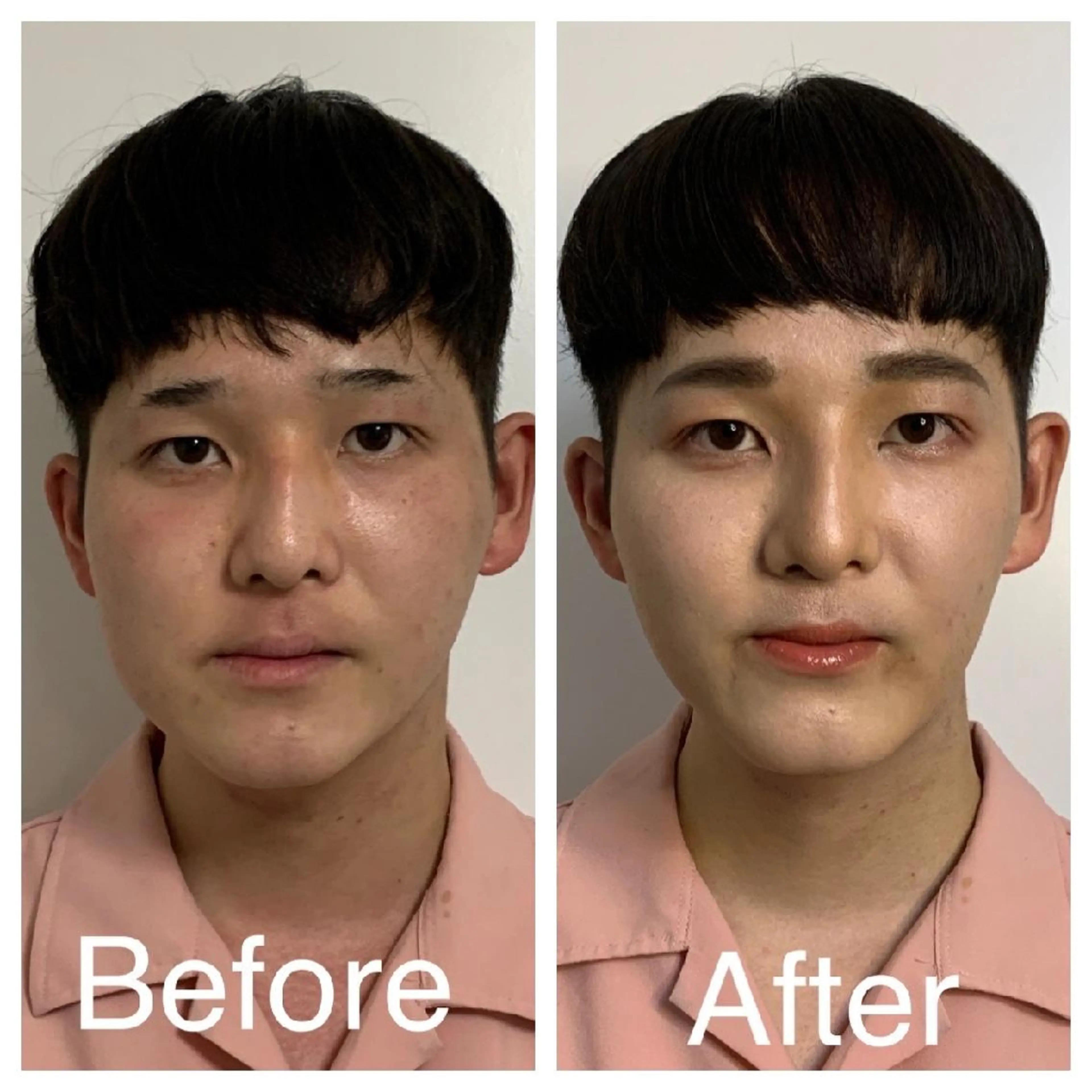 メンズ 医療提携Ruby所属・医療提携Ruby小顔 ハーブピーリングのその他イメージ