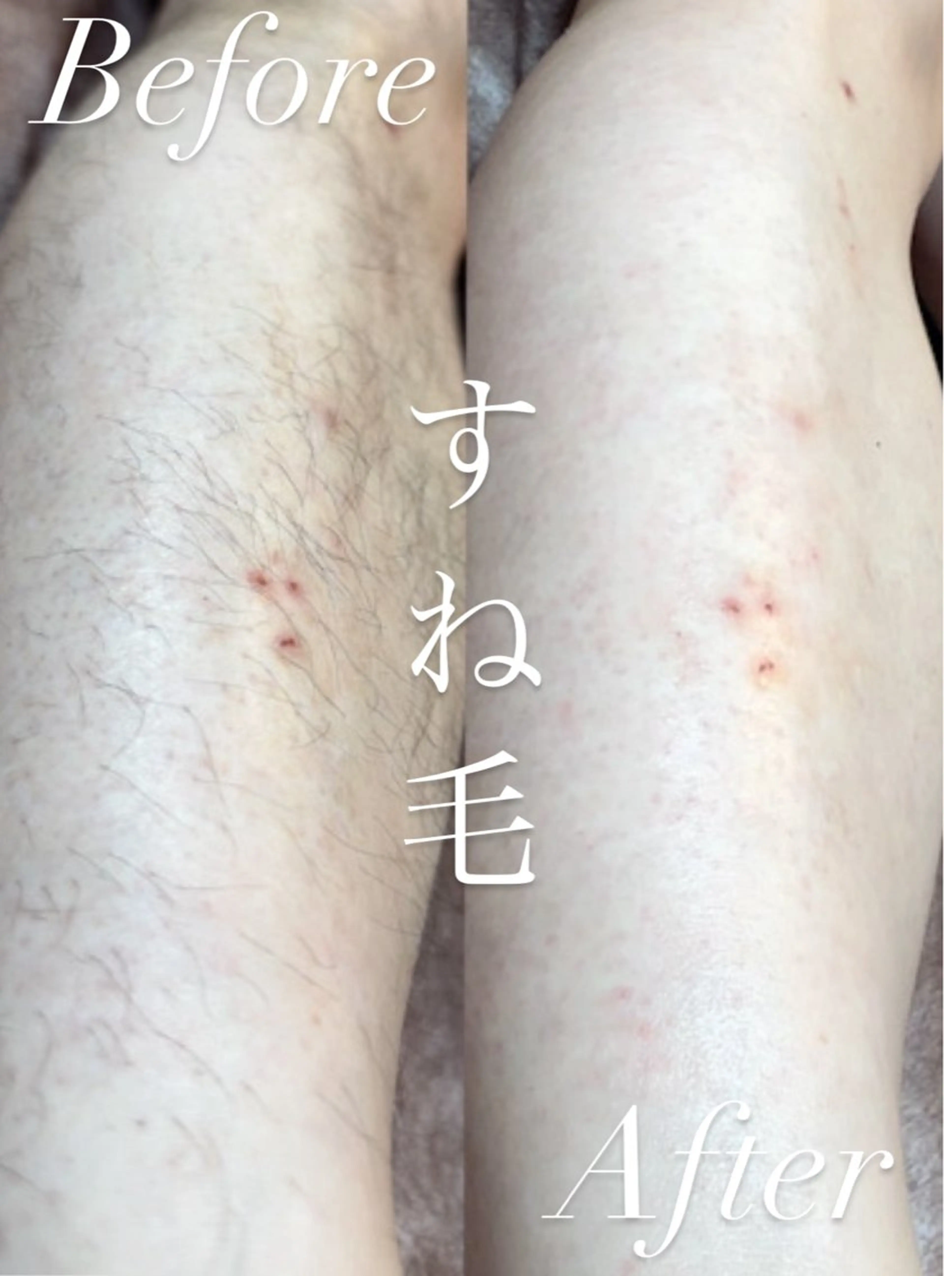 Hit. シュガーリング豊橋のエステ・リラクイメージ