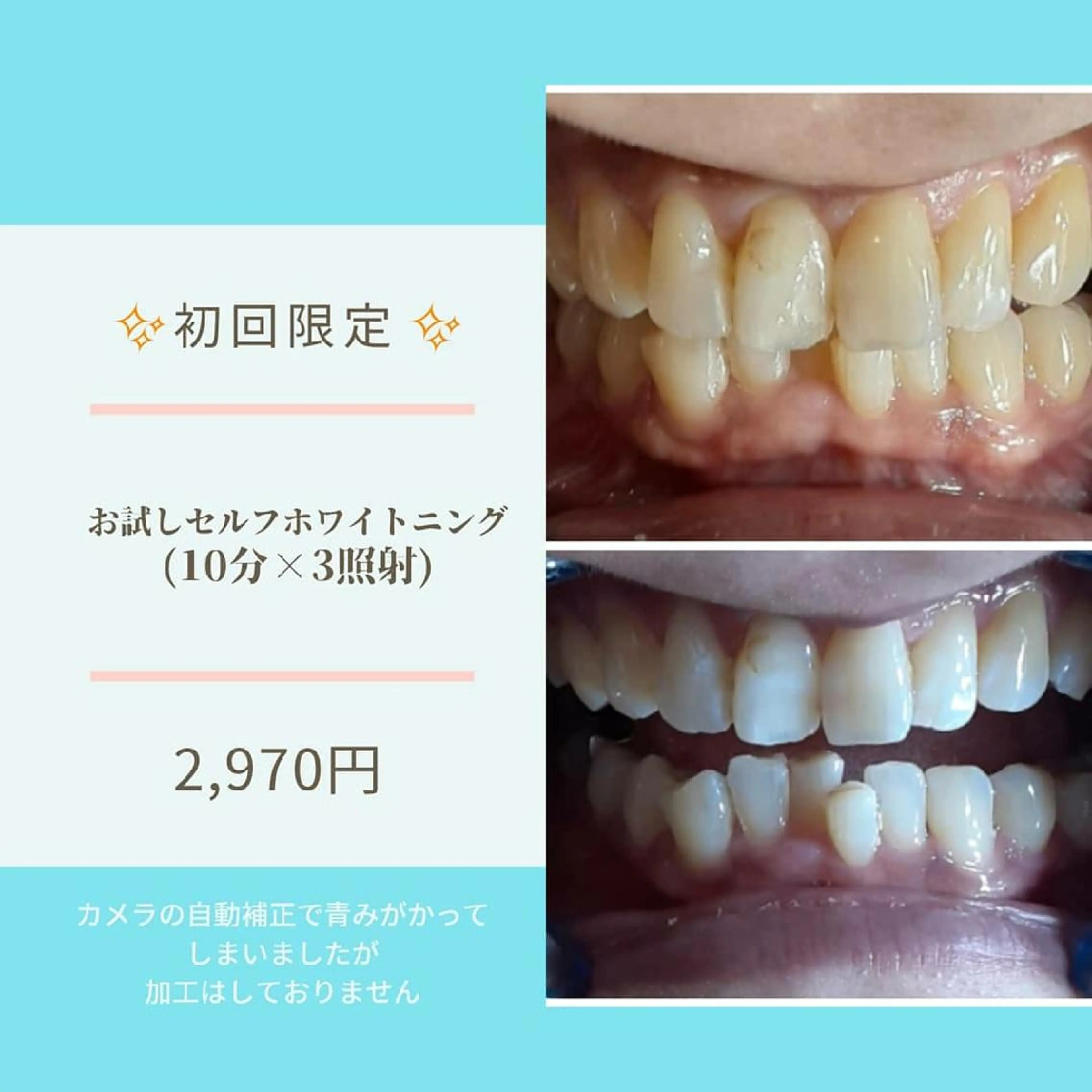 五十嵐 蓮のその他イメージ