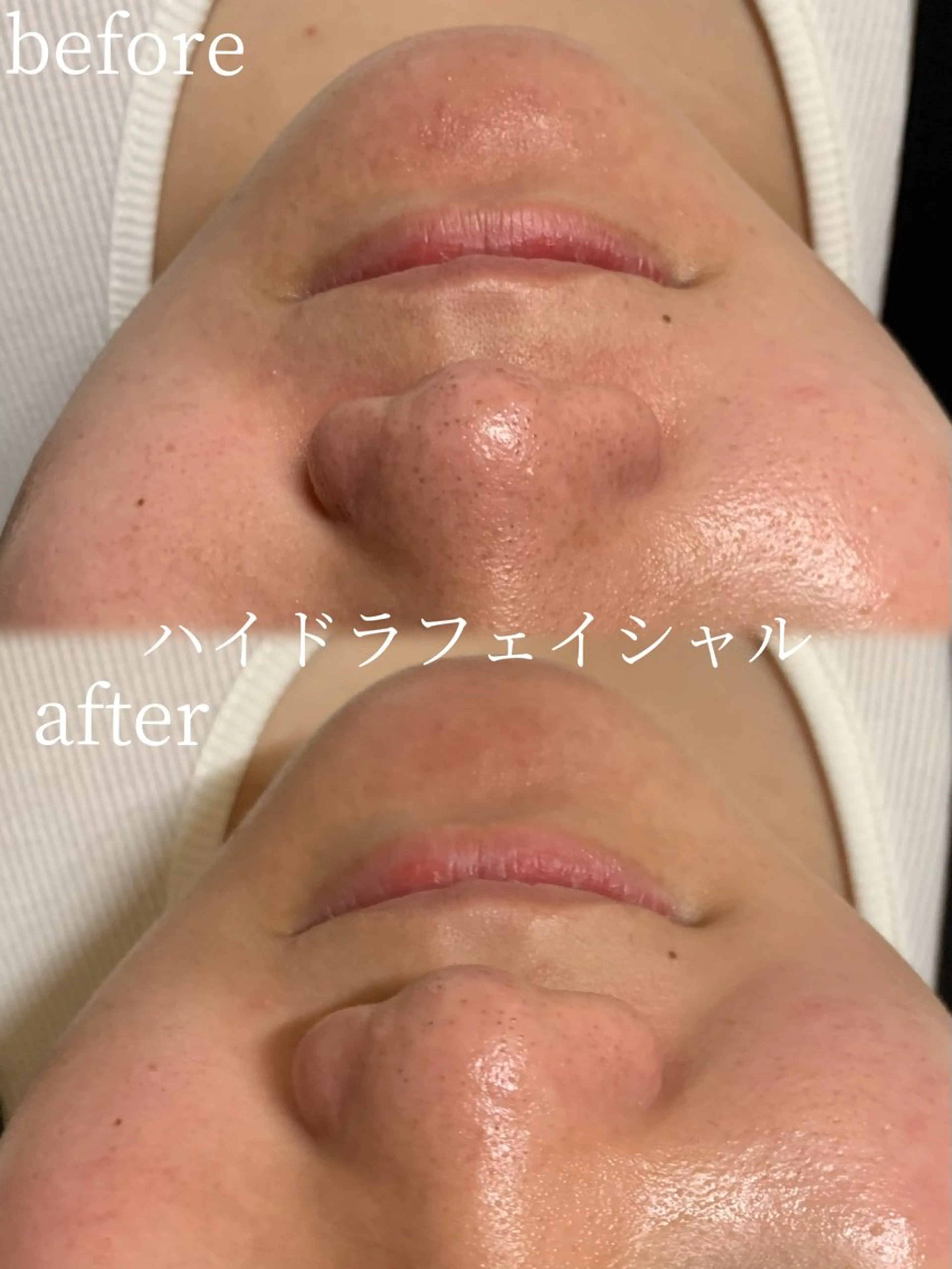 エステ リラク lifra CHISAのマツエク・マツパデザイン