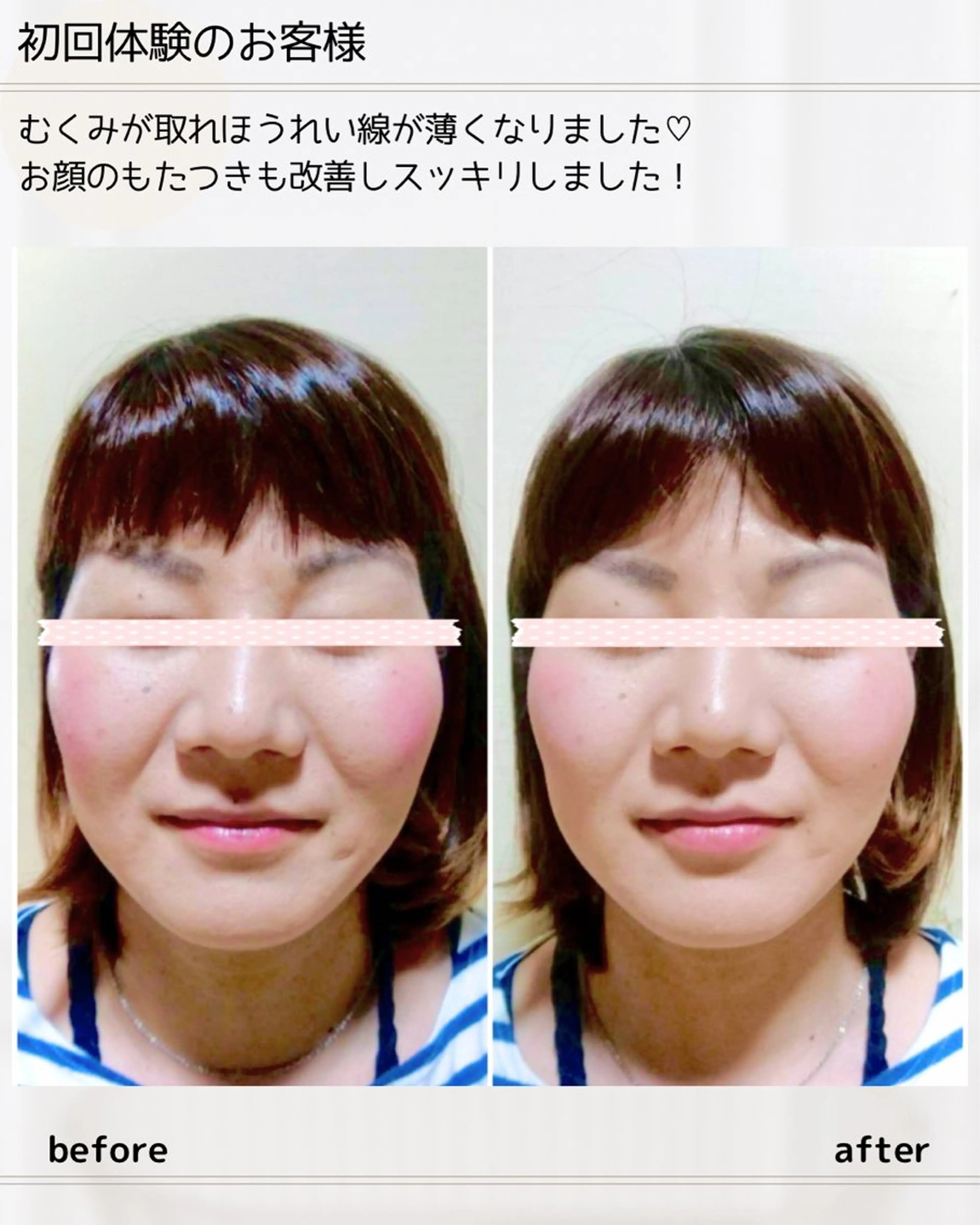 小顔矯正& 慢性肩こり腰痛改善店のエステ・リラクイメージ