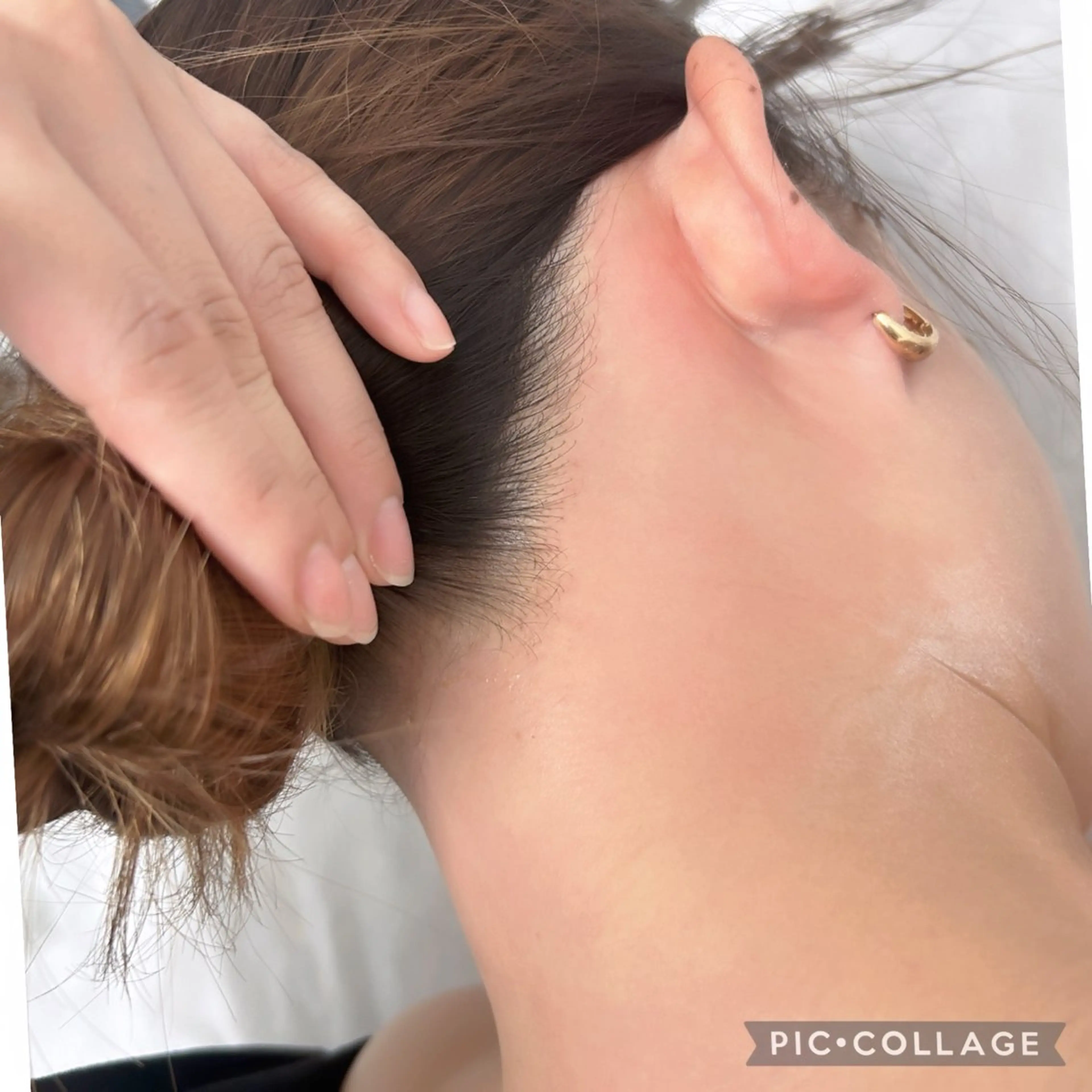 シュガーリング脱毛とSHR脱毛のMIX脱毛⭐️襟足の写真