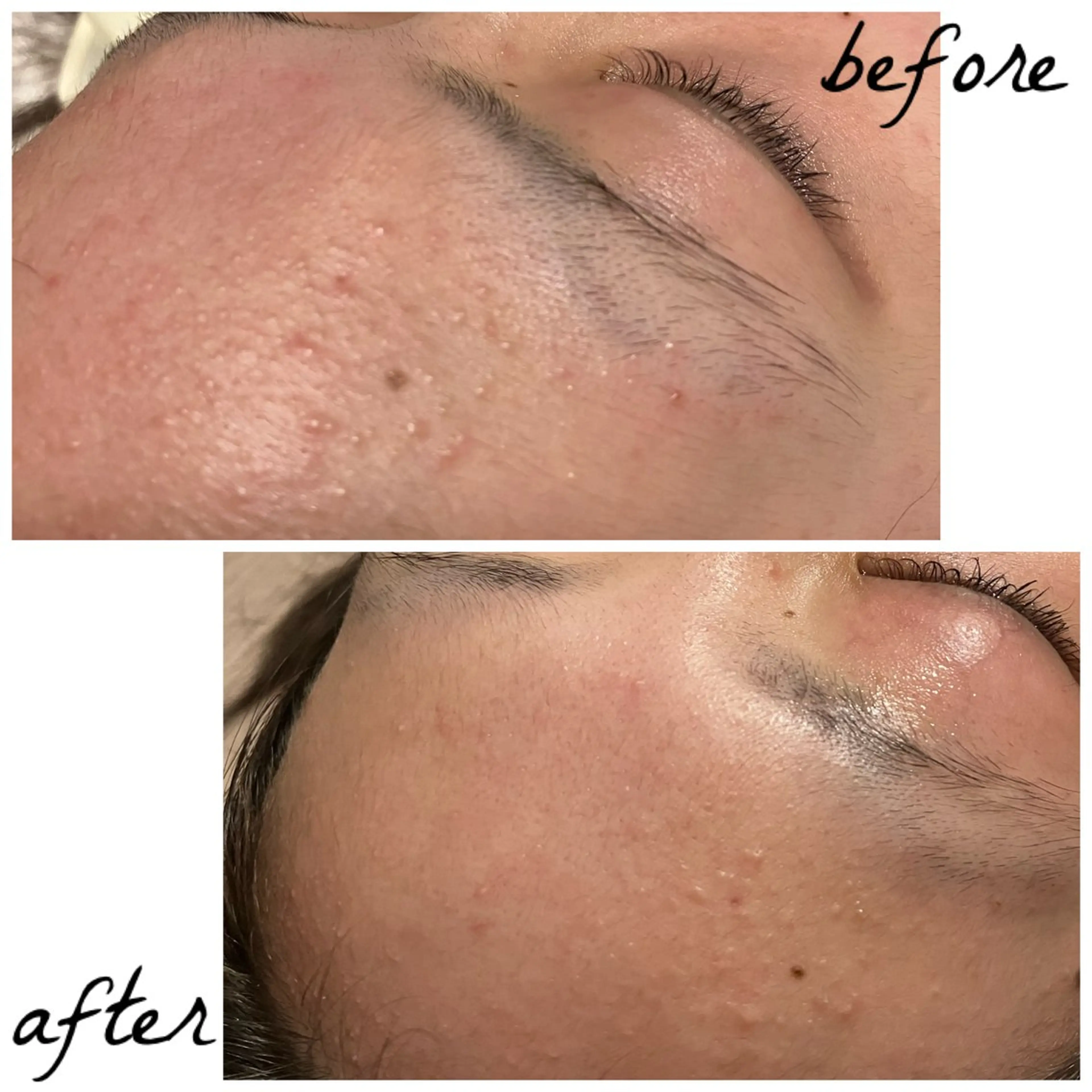 メンズ メナード岐阜茜部 杉浦のエステ・リラクイメージ