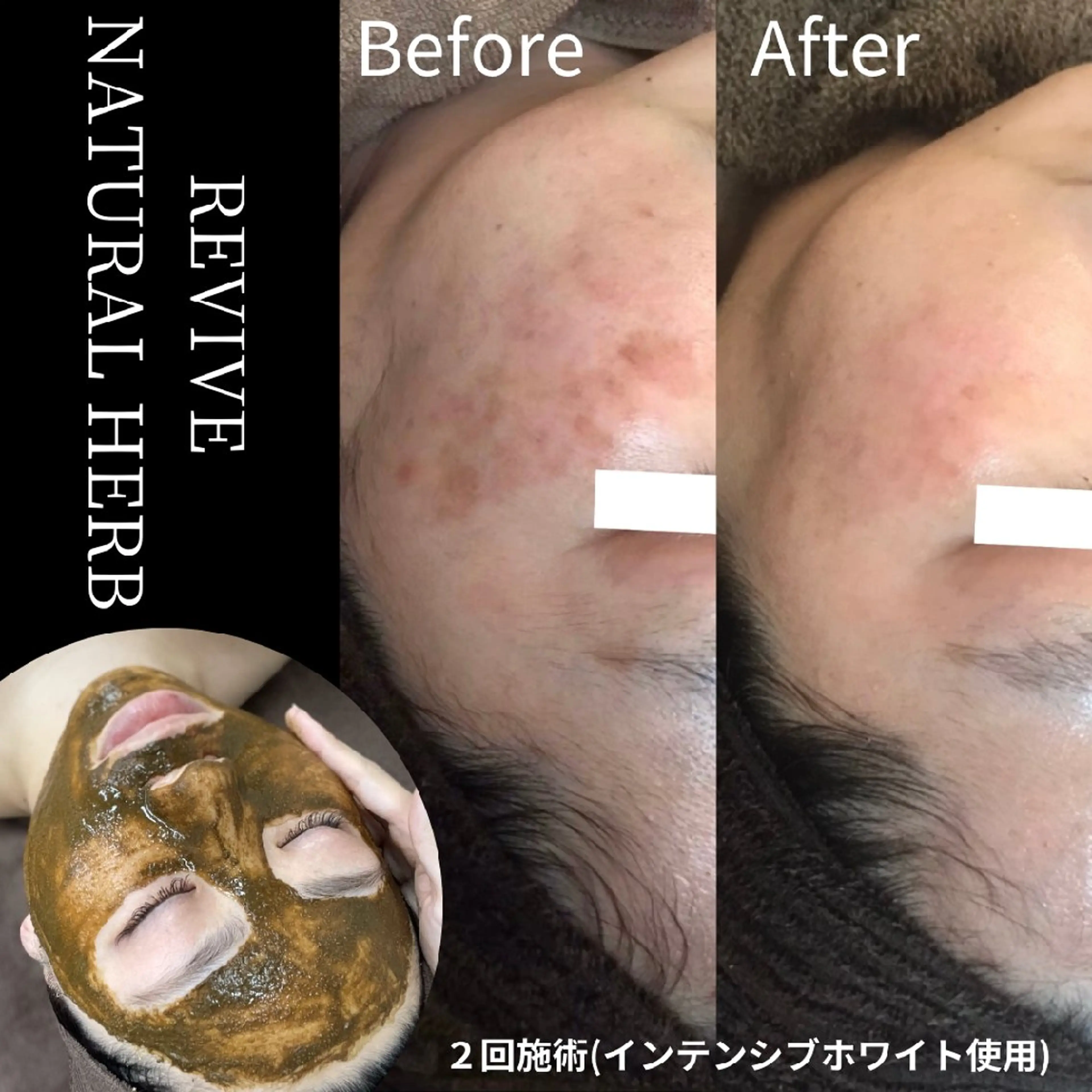 ユニセックスエステサロンUniclear所属・痩身&フェイシャル Uniclearのエステ・リラクイメージ