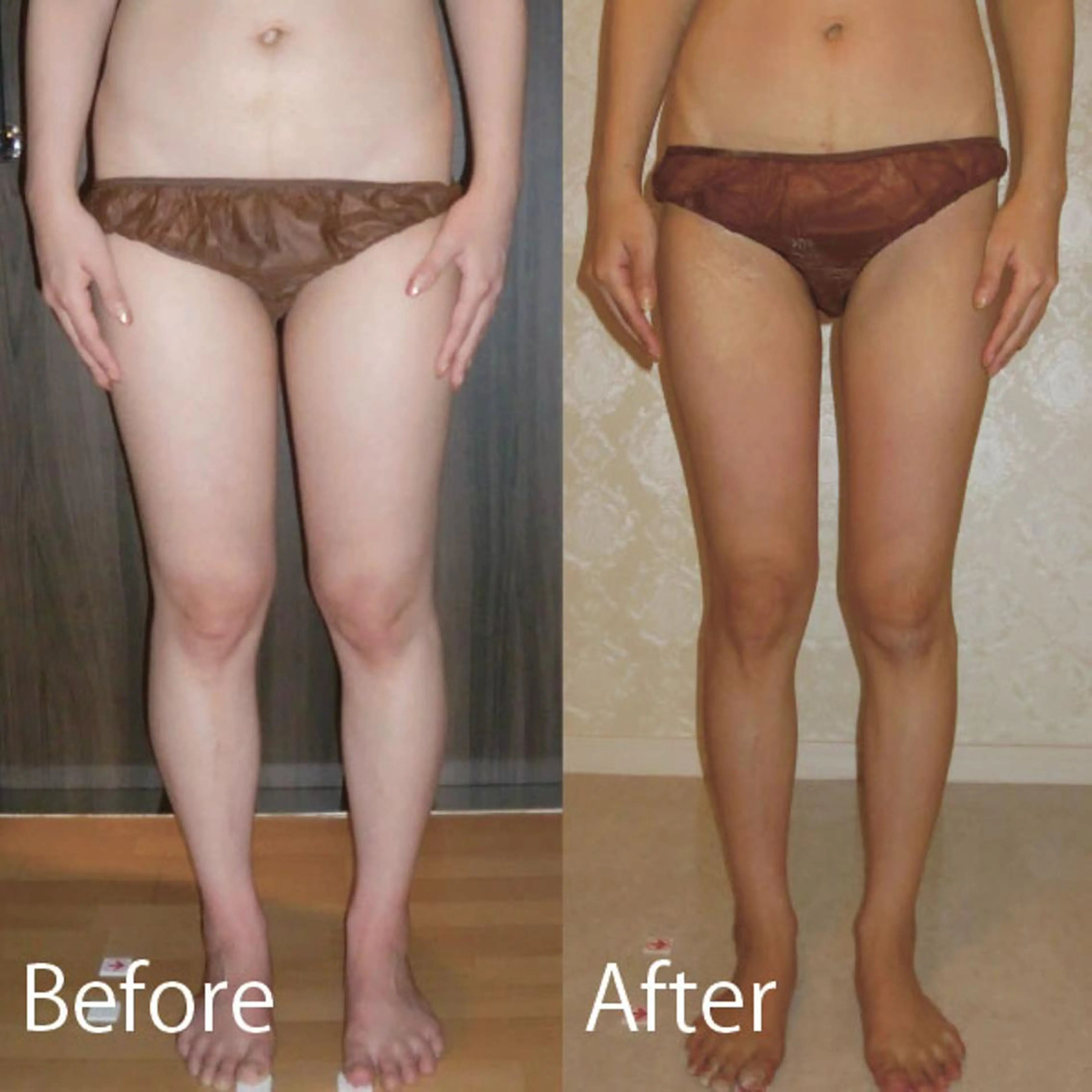 脚やせ専門ダイエット ルメートルセラピーのエステ・リラクイメージ