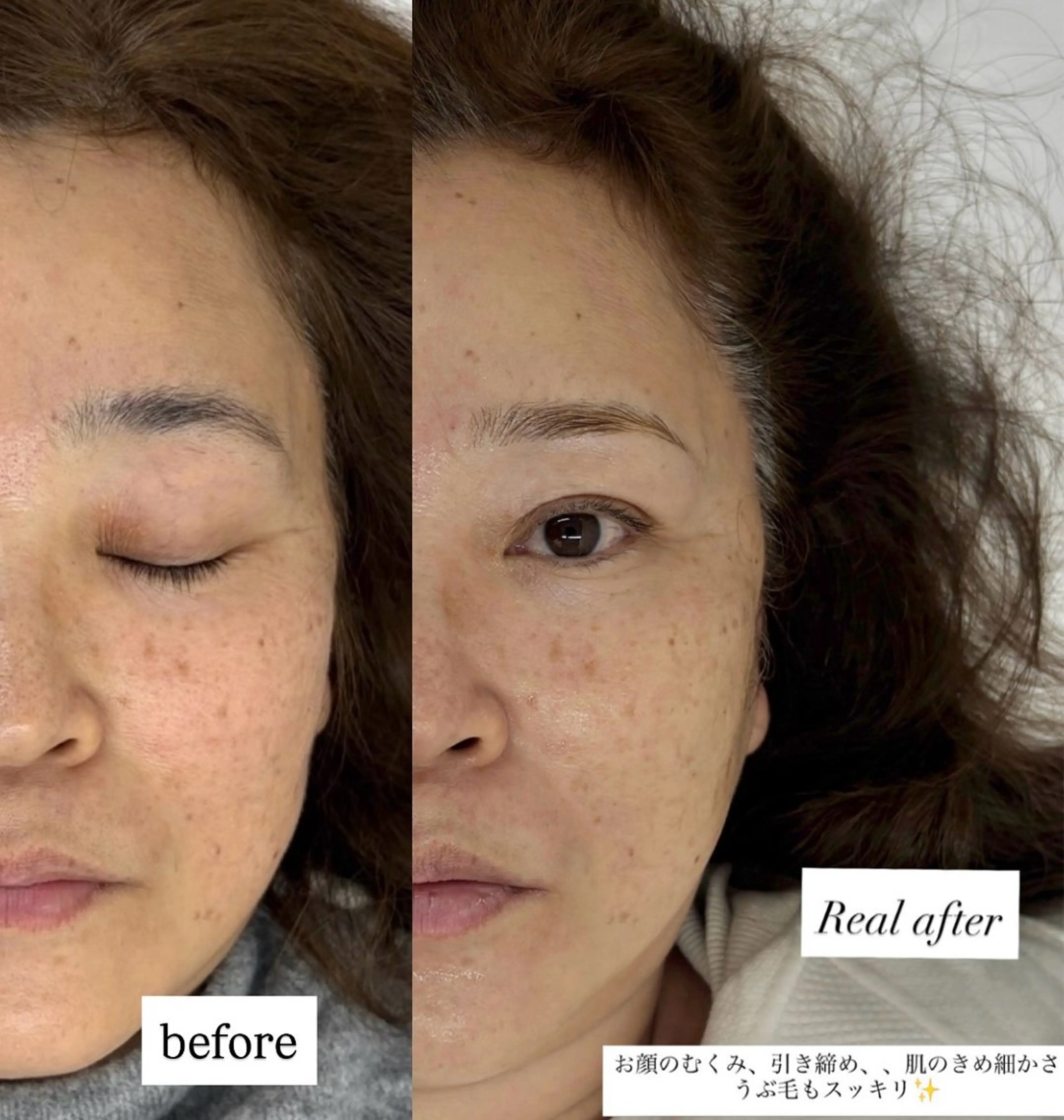 エステ 垢抜け美眉肌♡ /momoka.kaのエステ・リラクイメージ