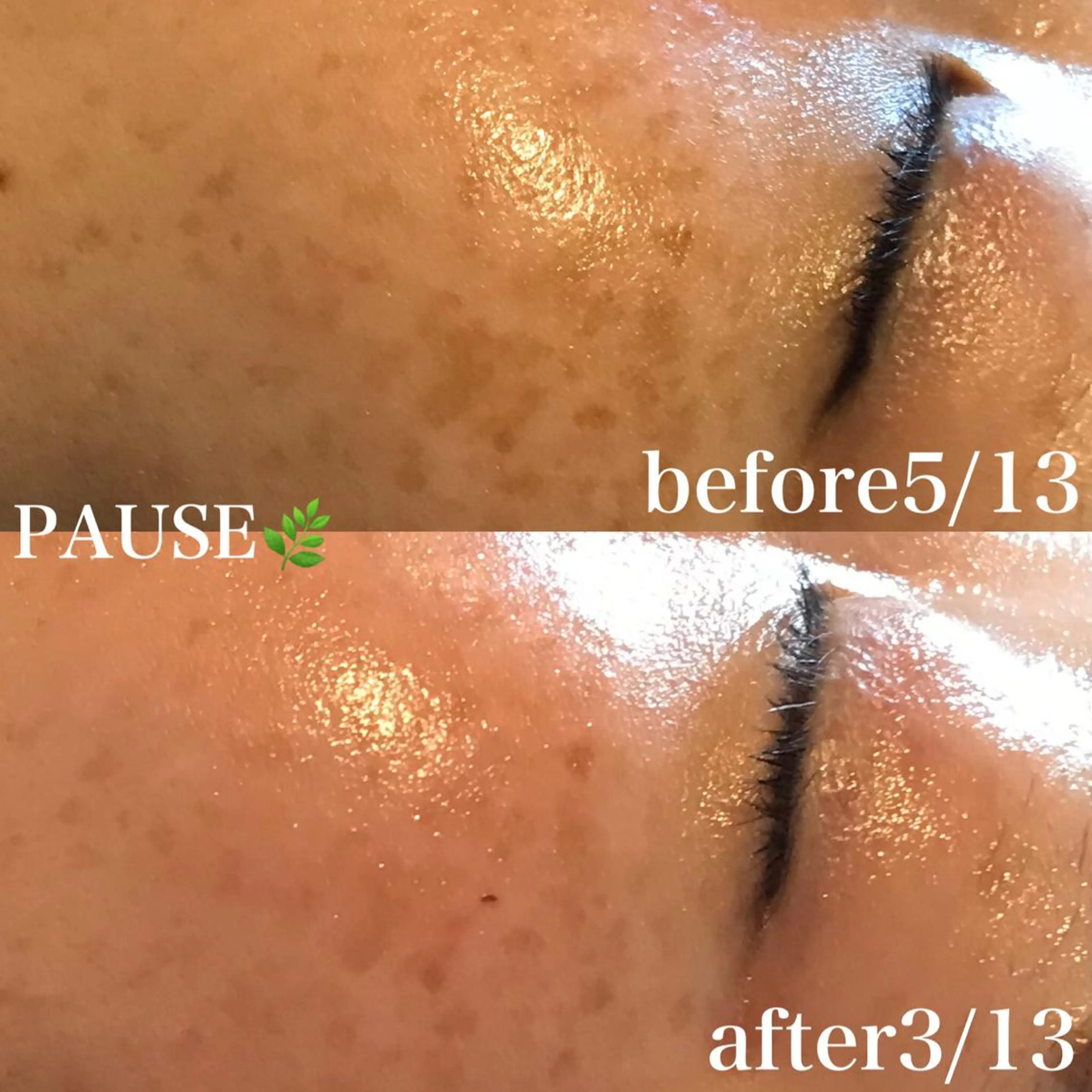 エステ 浜野 恵美のエステ・リラクイメージ