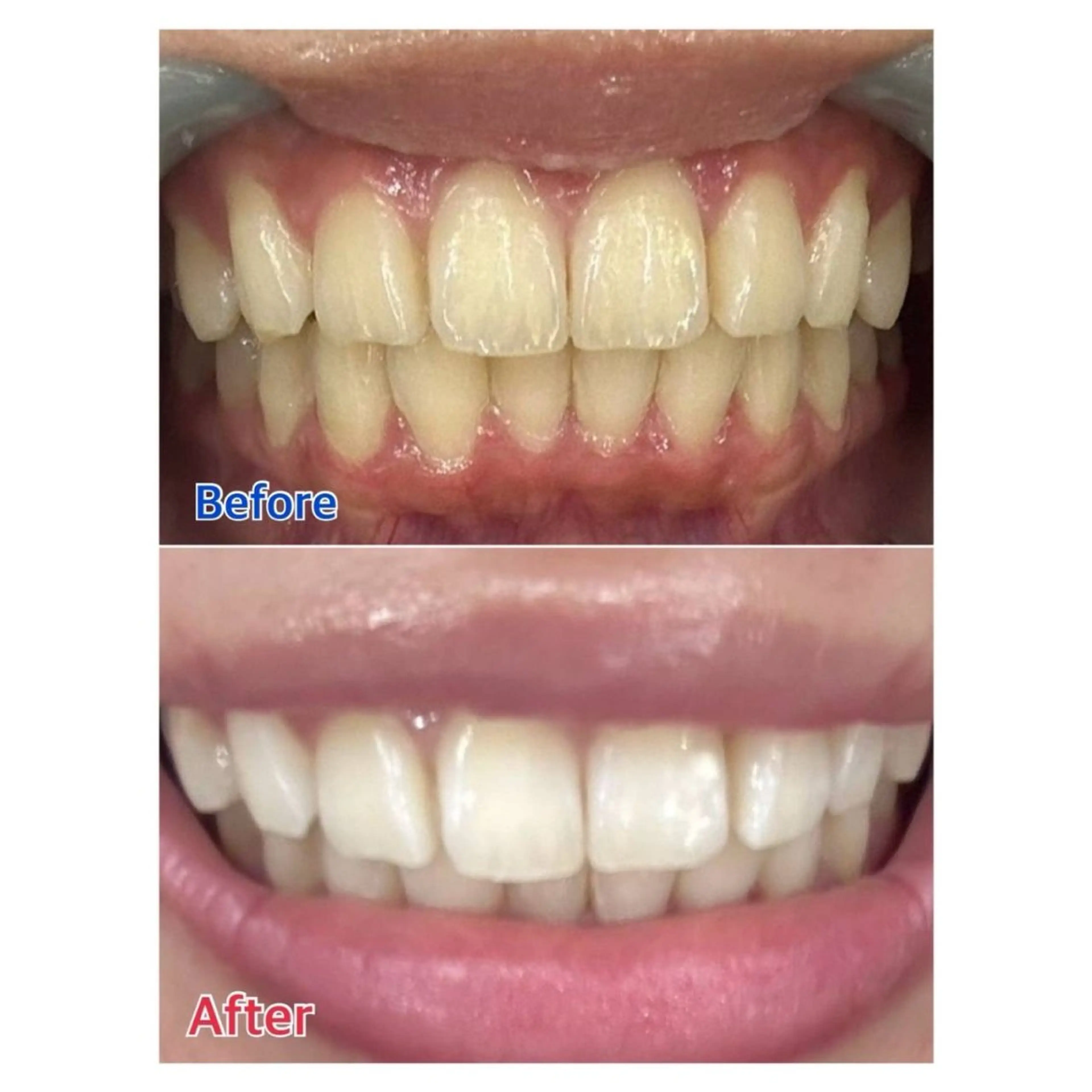 MBEAUTYSALON 千葉店・京成大久保所属・Melty 輝のその他イメージ