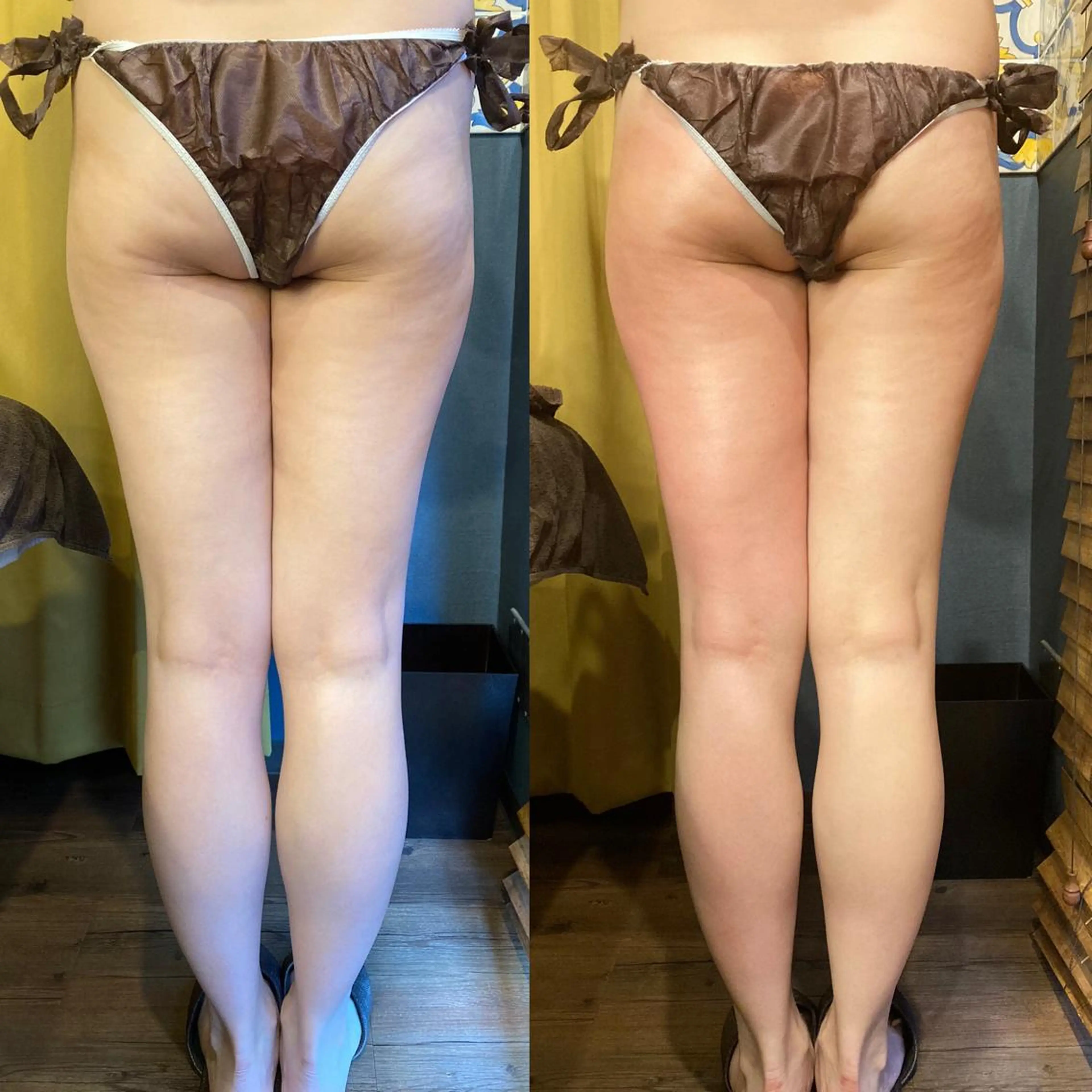 小顔やたるみに特化 💚野瀬可蓮のその他イメージ