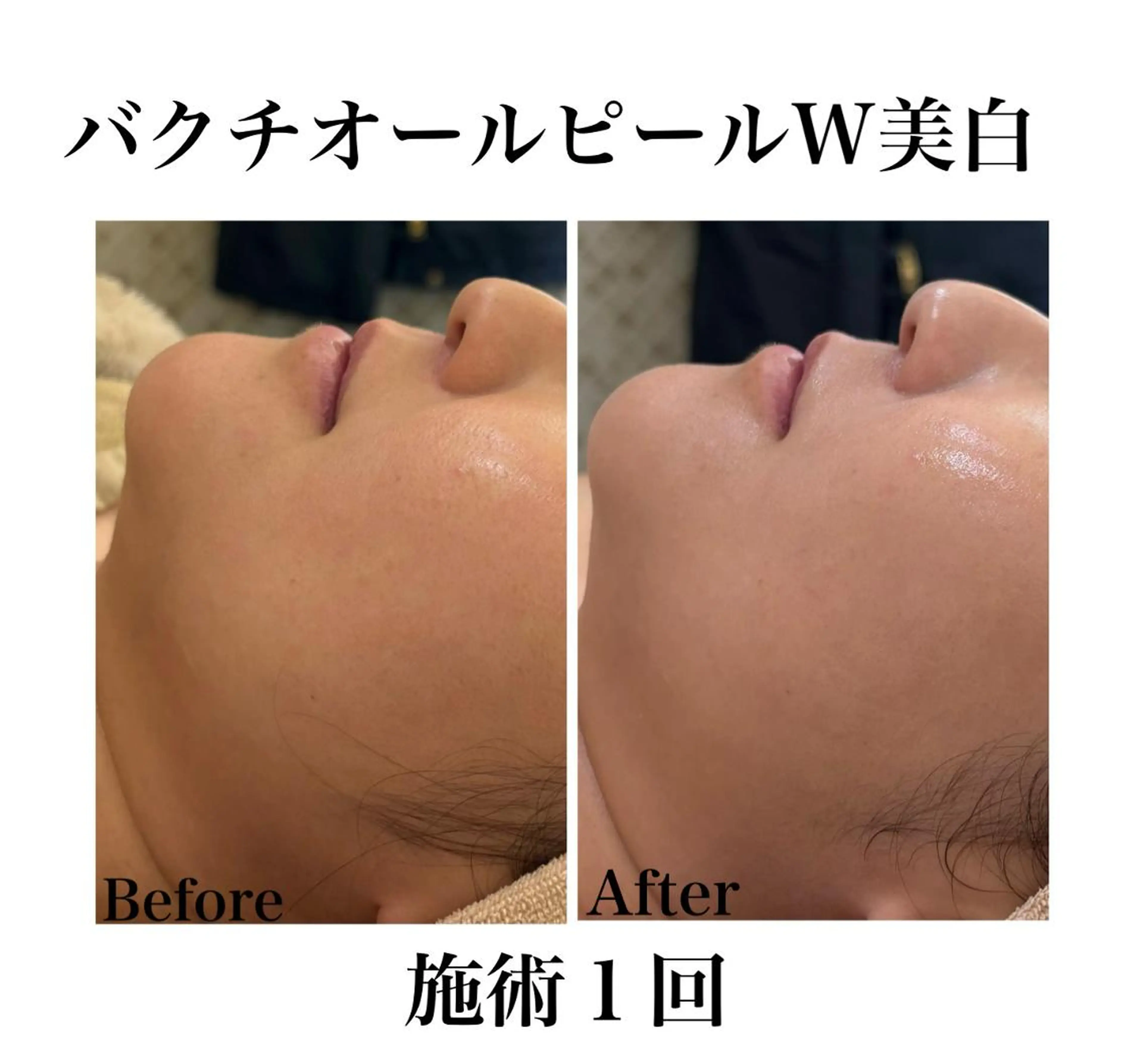 エステ リラク 《美肌&小顔サロン》 Masqueradeのエステ・リラクイメージ