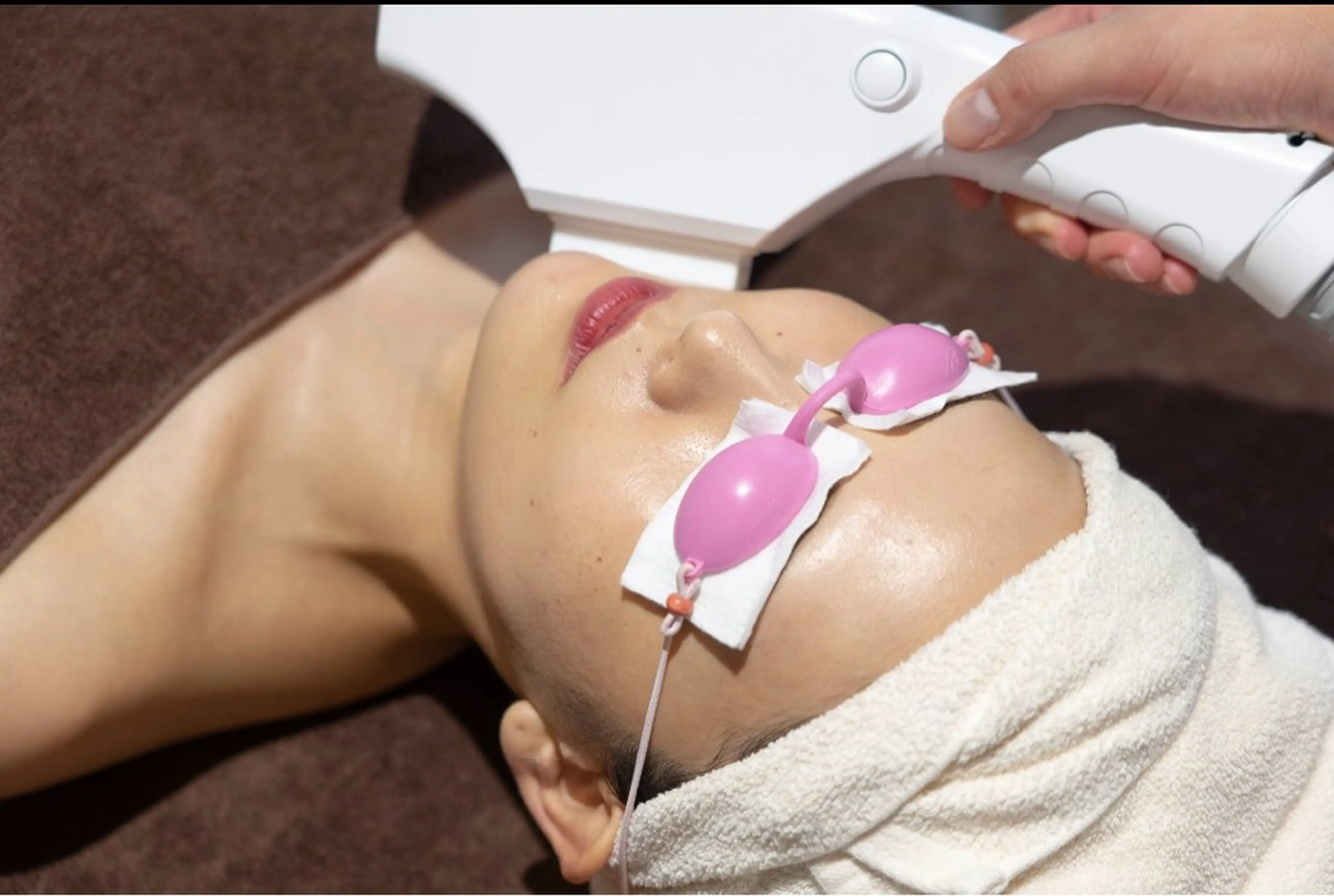 光フェイシャル【ニキビ、赤ら顔、シミが気になってる方💆🏻✨】の写真