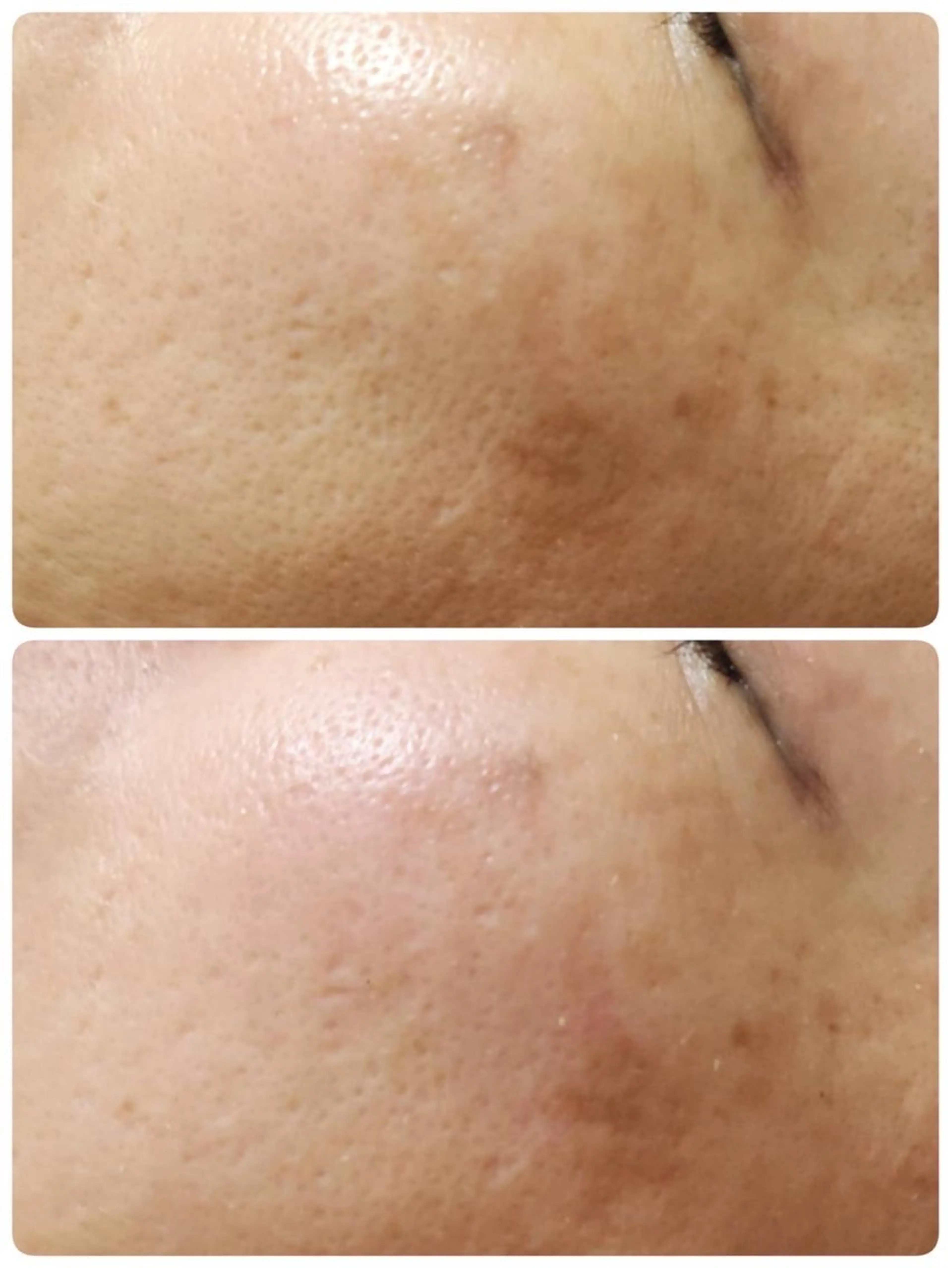 その他 Astorie 相模大野エステのその他イメージ