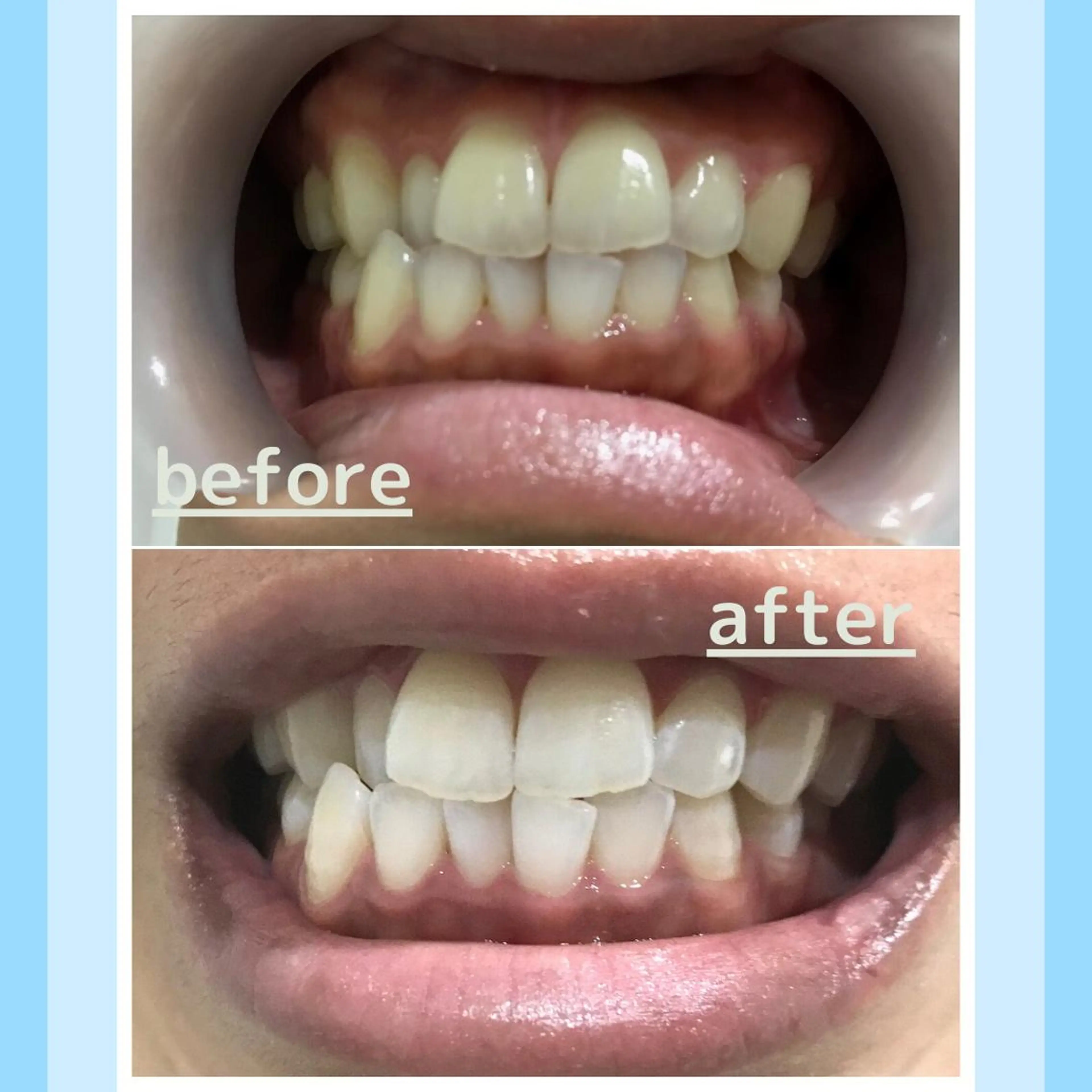 メンズ その他 お手軽ホワイトニングsalon mina所属・武元 奈津美のその他イメージ