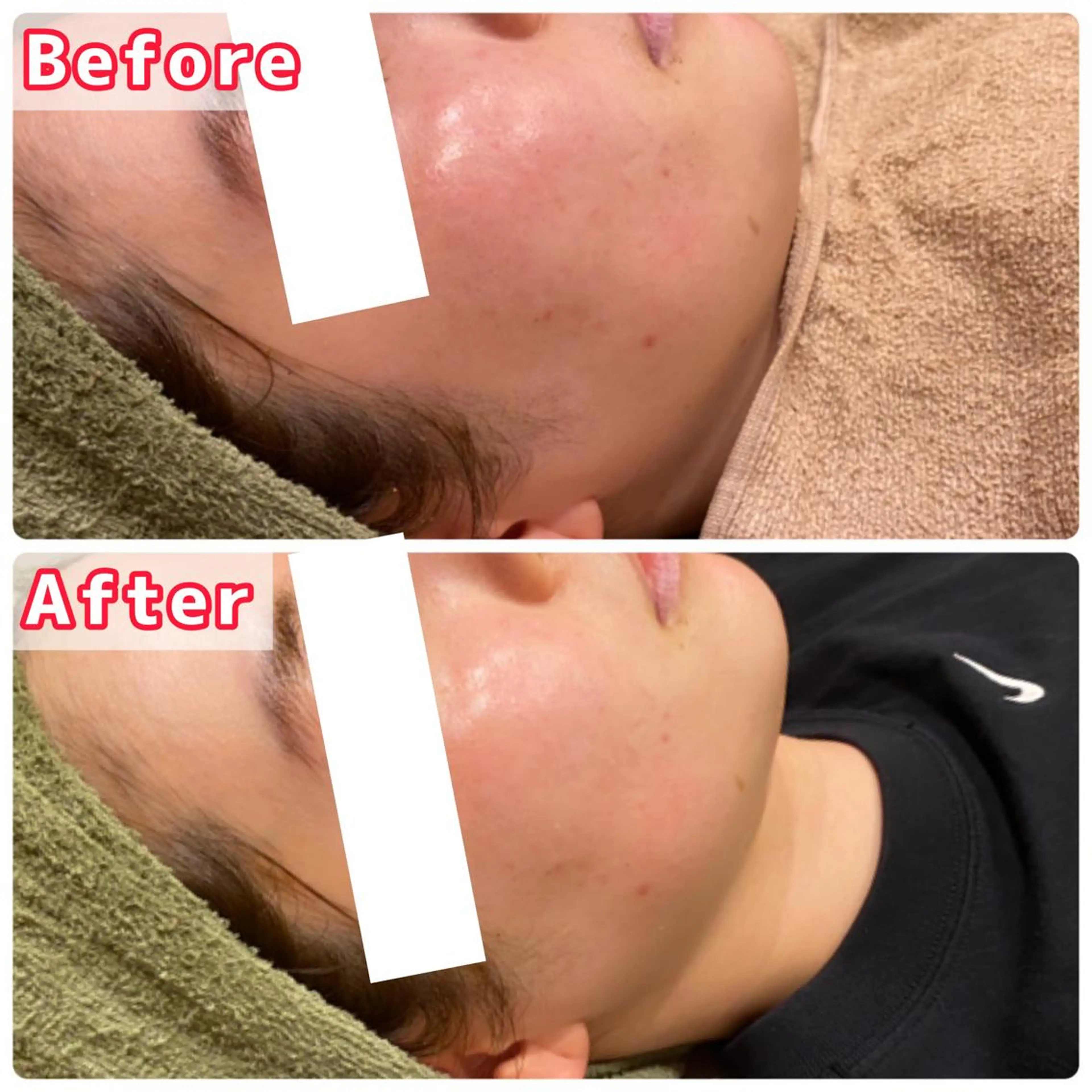 ハーブピーリング専門 muro.のエステ・リラクイメージ