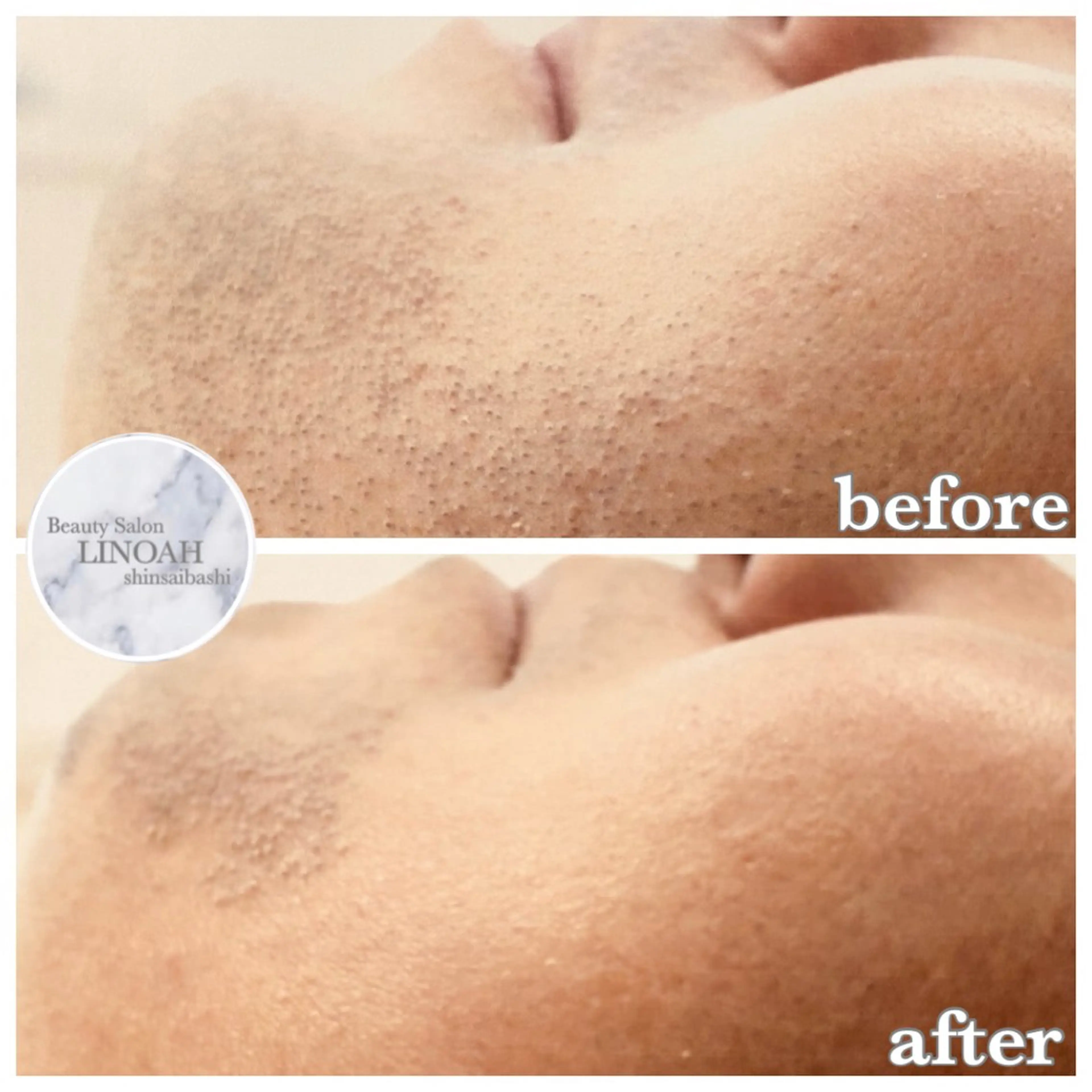 メンズ ビューティーサロン リノア心斎橋店のエステ・リラクイメージ