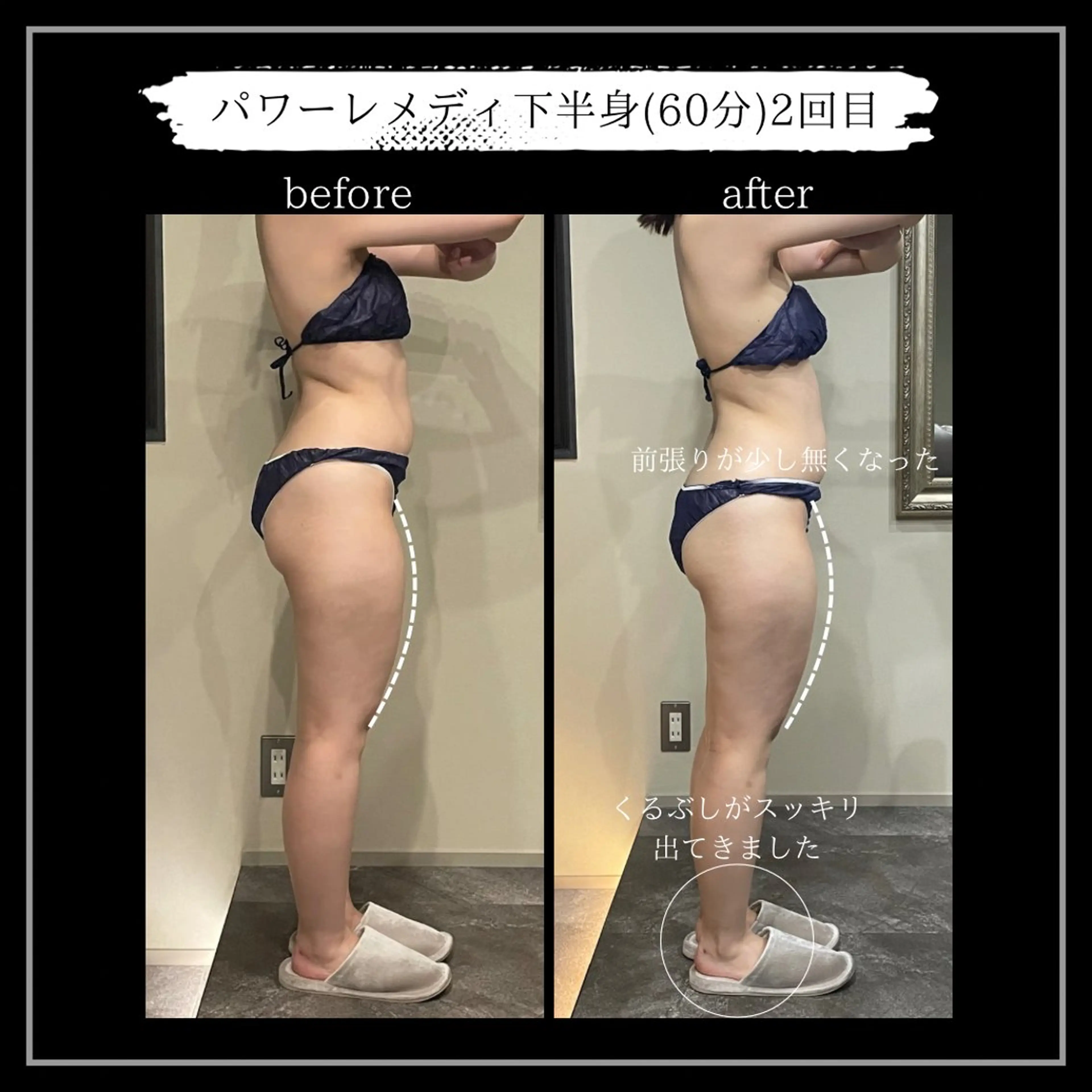 オフ:オン所属・オフ:オン 全身筋膜マッサージのエステ・リラクイメージ