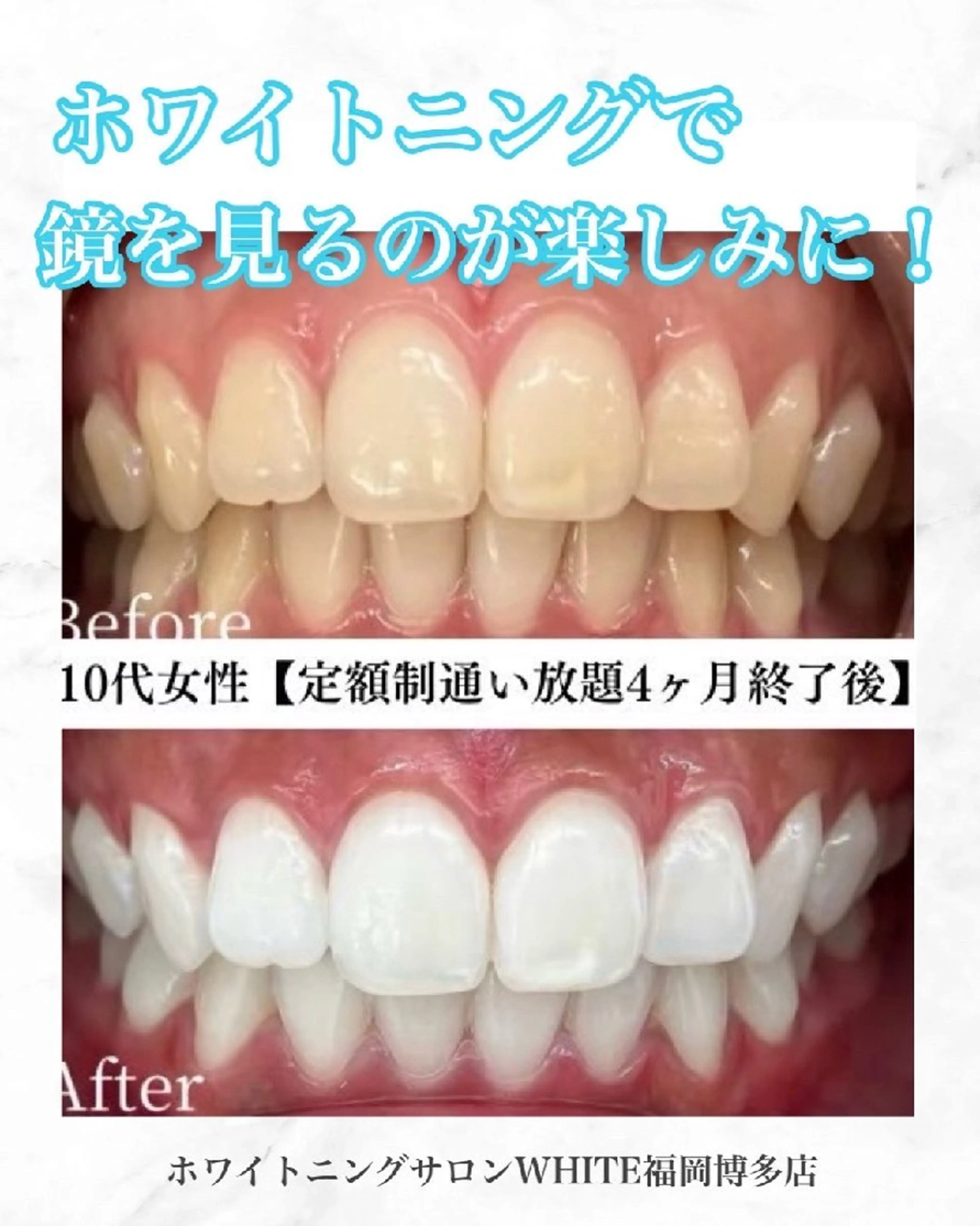 メンズ キッズ 撮影モデル セルフホワイトニング WHITE福岡博多店のエステ・リラクイメージ