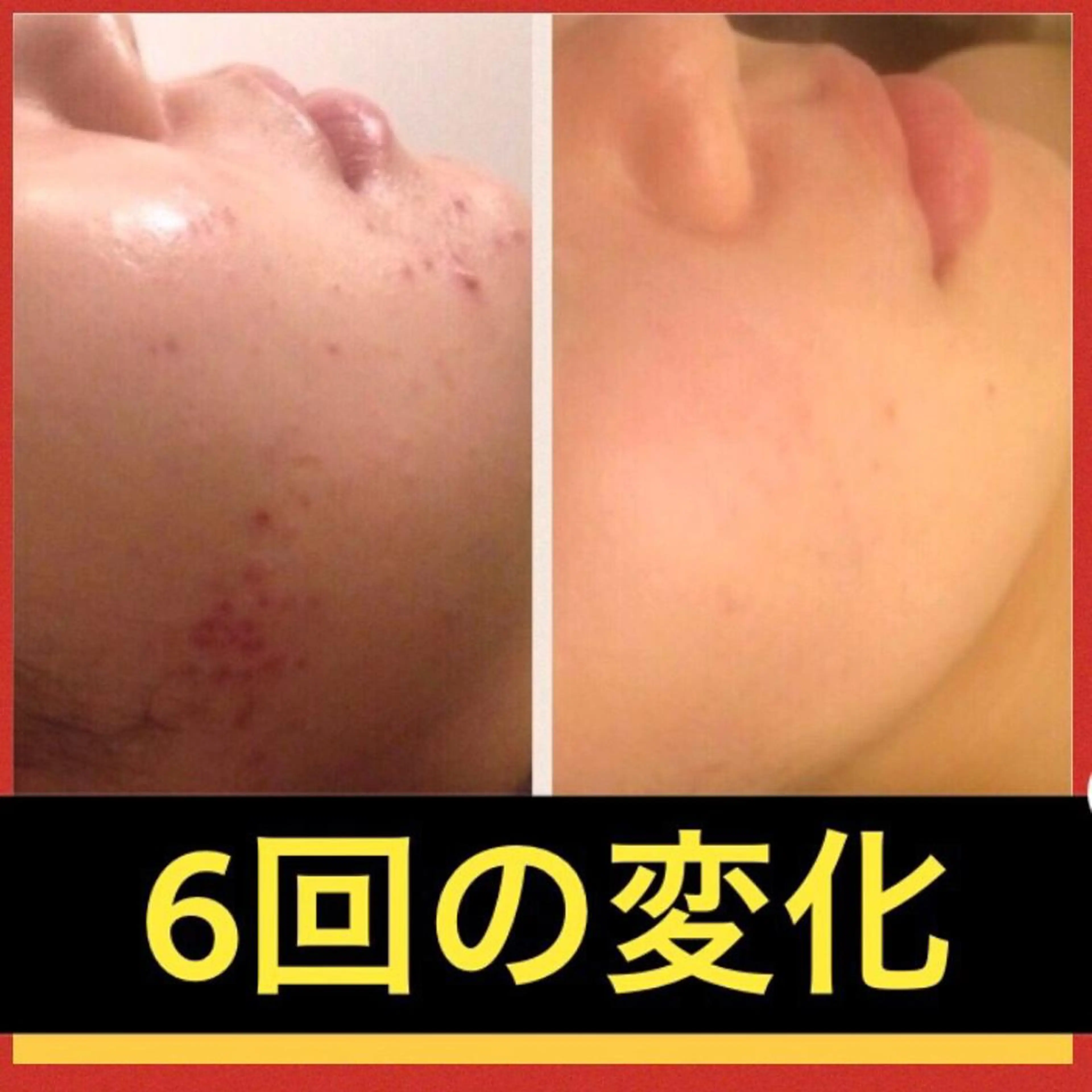 ミディアム カラー パーマ ヘアアレンジ メンズ キッズ ネイル マツエク・マツパ エステ リラク ニキビ・肌質改善専門 ♡人生が変わるサロンのエステ・リラクイメージ