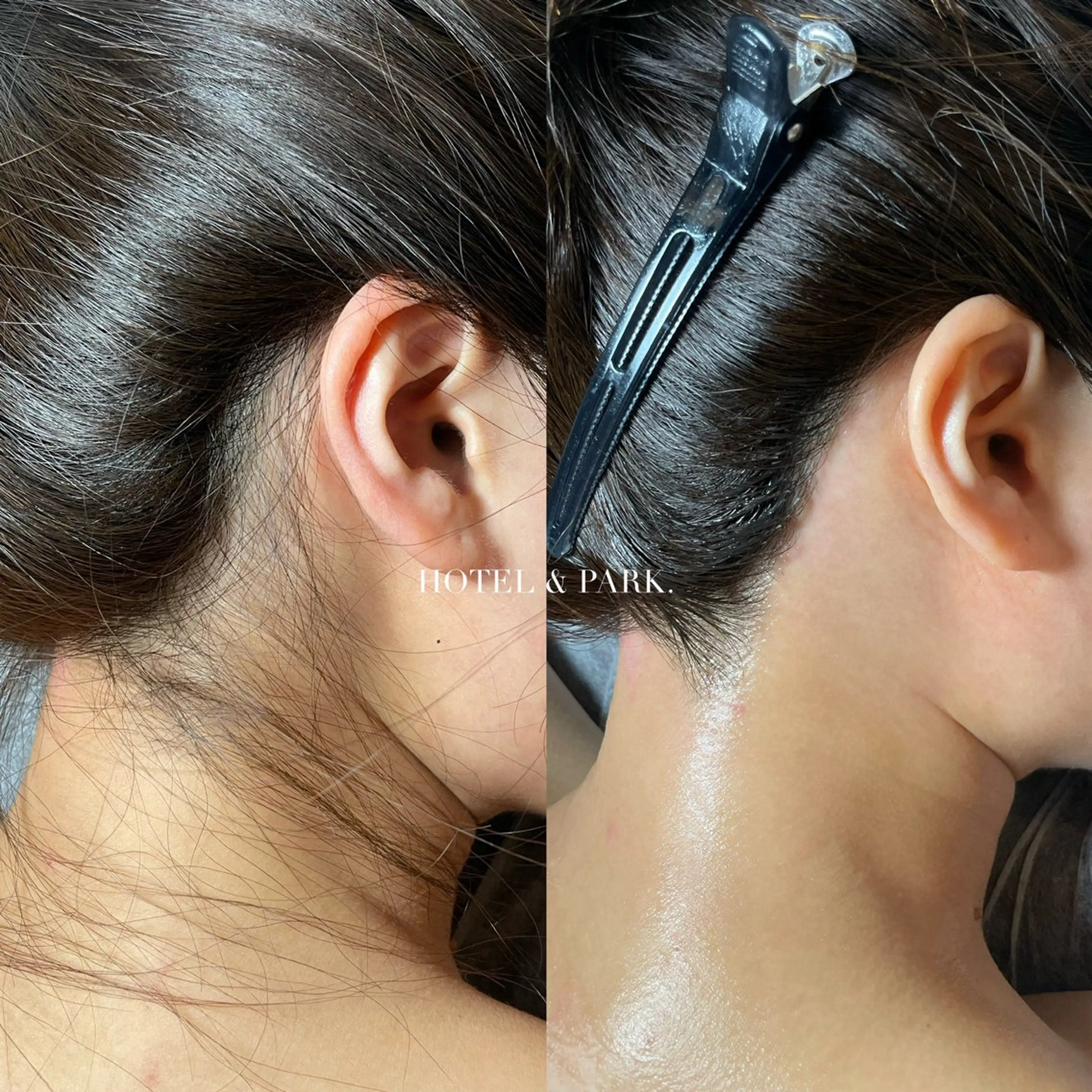 ロング ロング 脱毛 HOTEL&PARK . ワックス脱毛のエステ・リラクイメージ