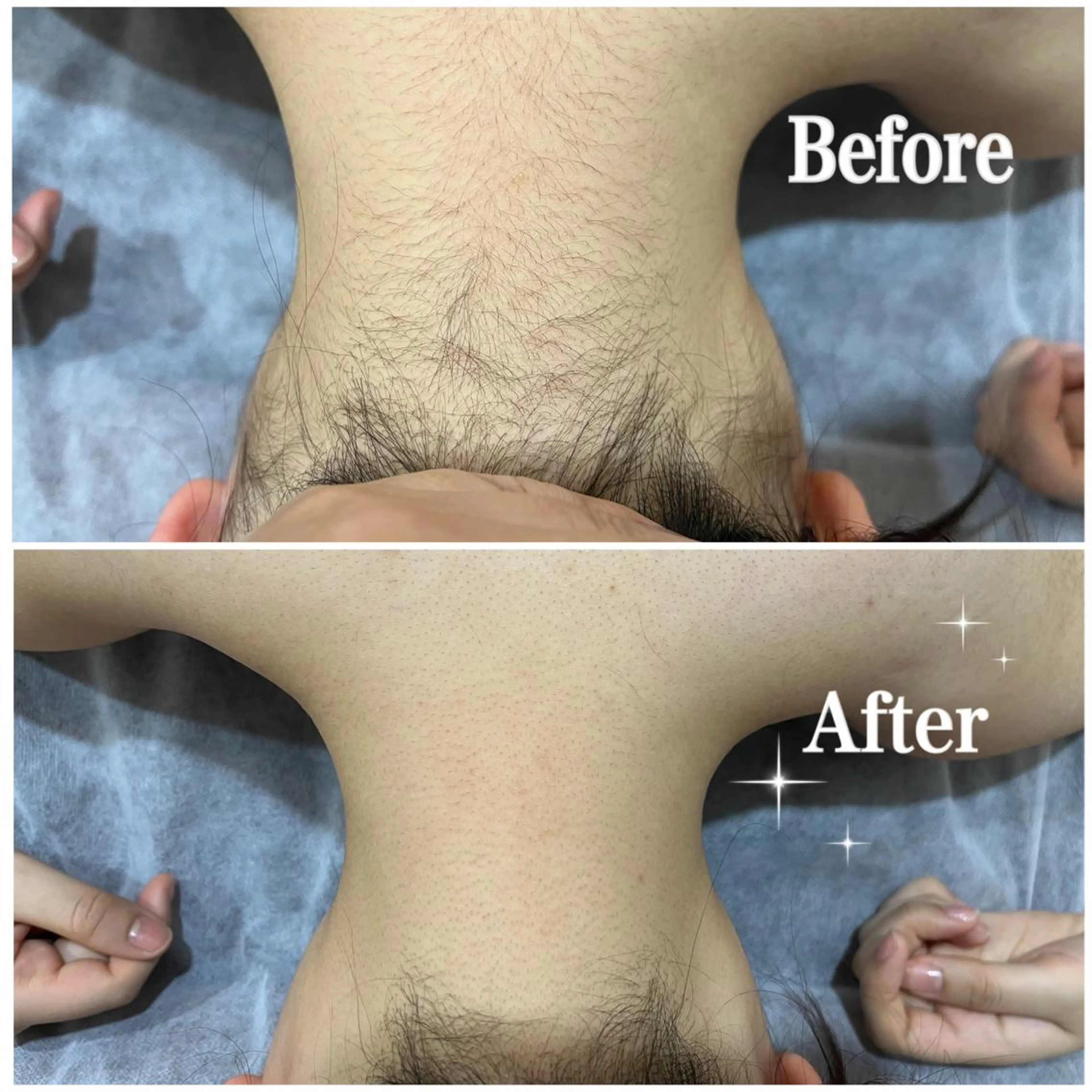 脱毛サロン fam.豊澤柚良のエステ・リラクイメージ