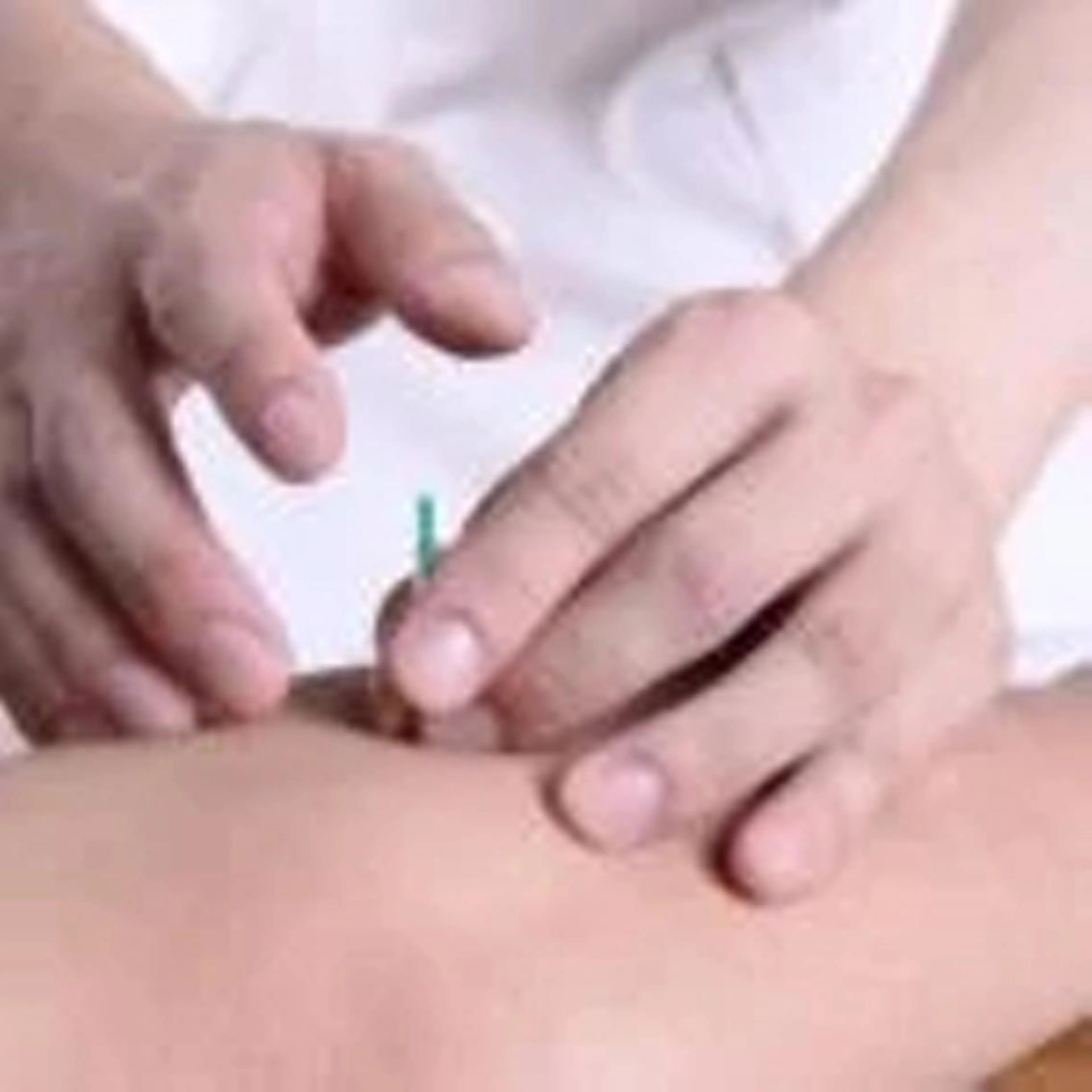 不妊施術の写真