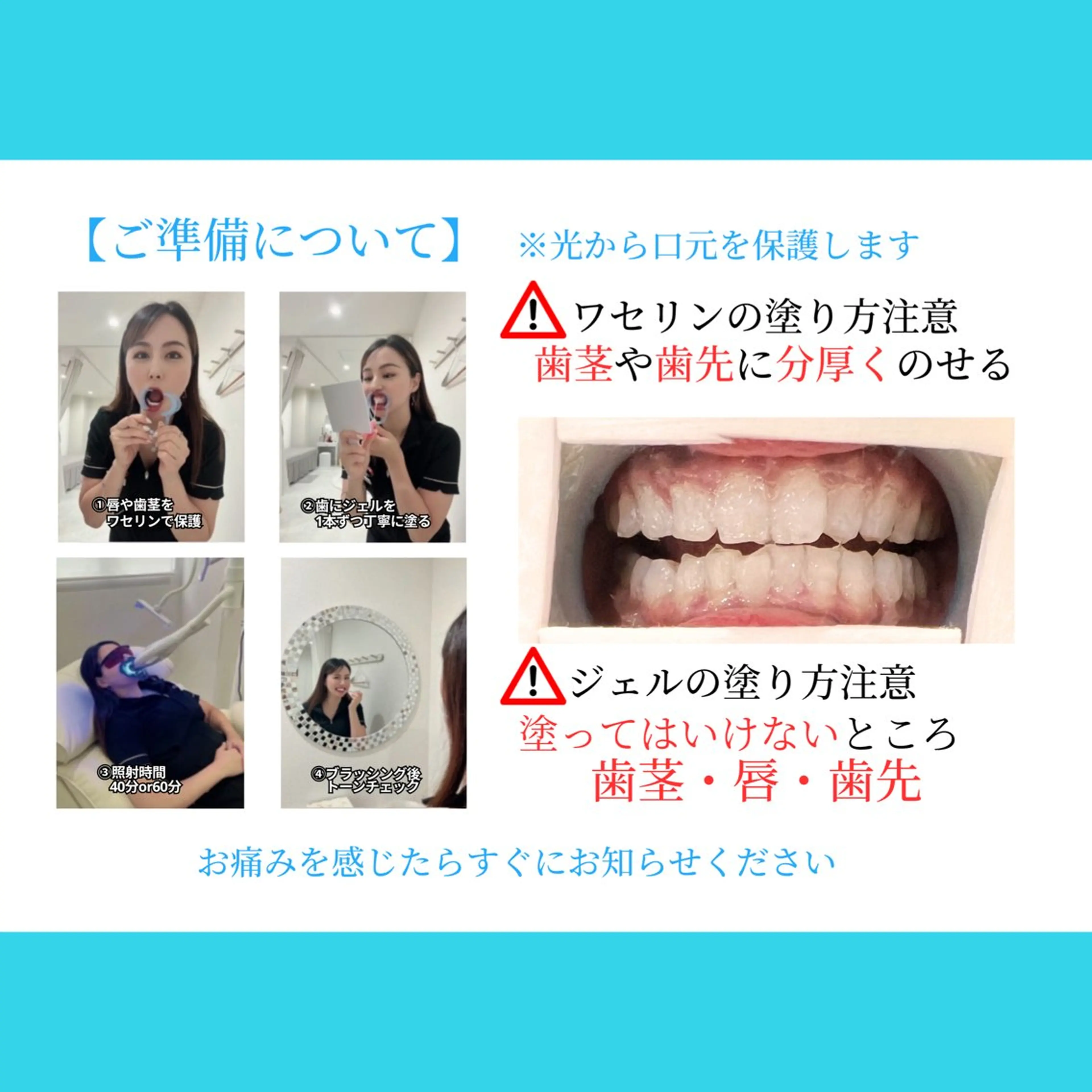 ホワイトニング ショップ多摩店のその他イメージ