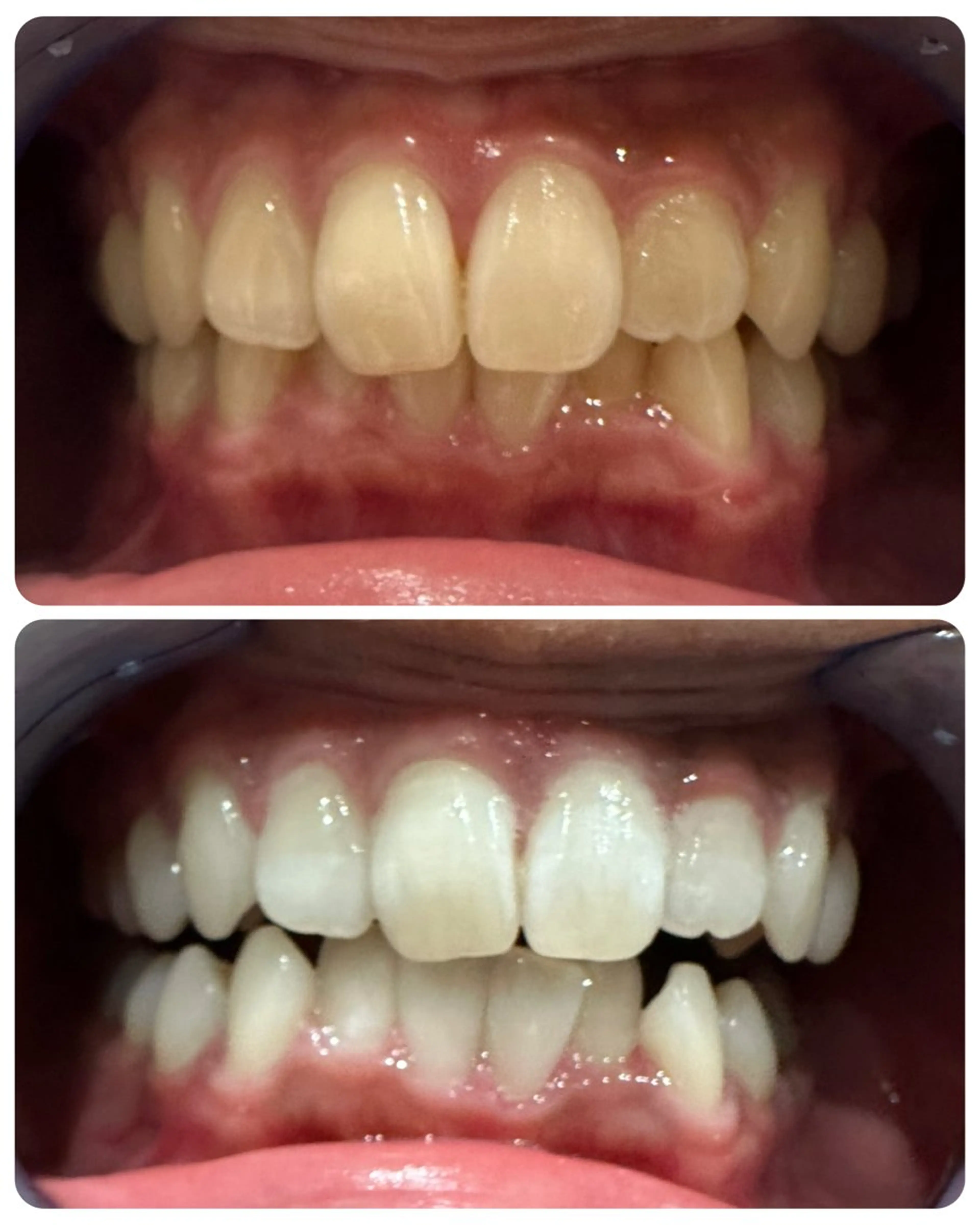 エステ The Salon 脱毛&眉毛スタイリング&セルフホワイトニング所属・The Salon 脱毛&眉毛の眉毛・アイブロウイメージ