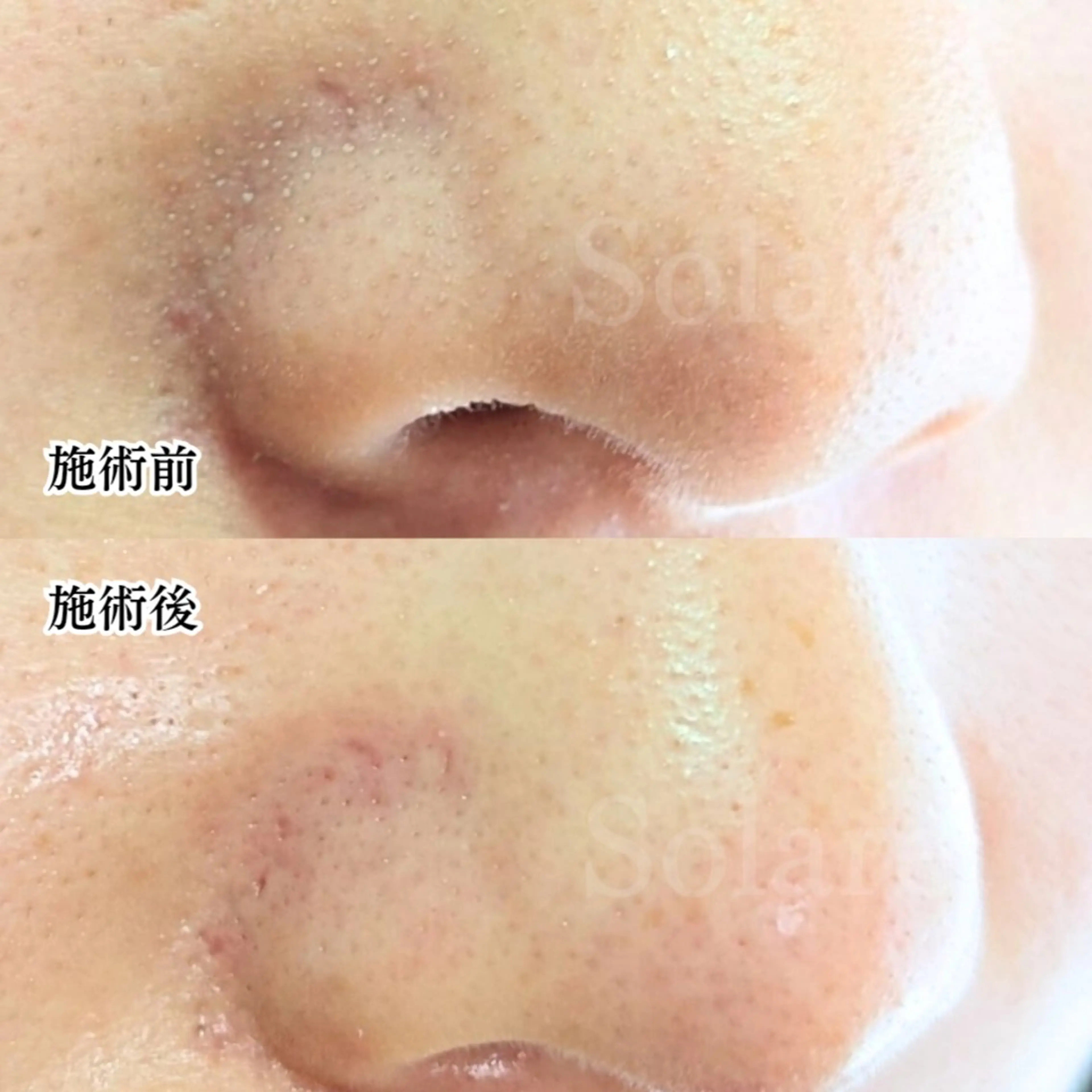  毛穴洗浄・まつ毛 の専門店 ソラーレのエステ・リラクイメージ