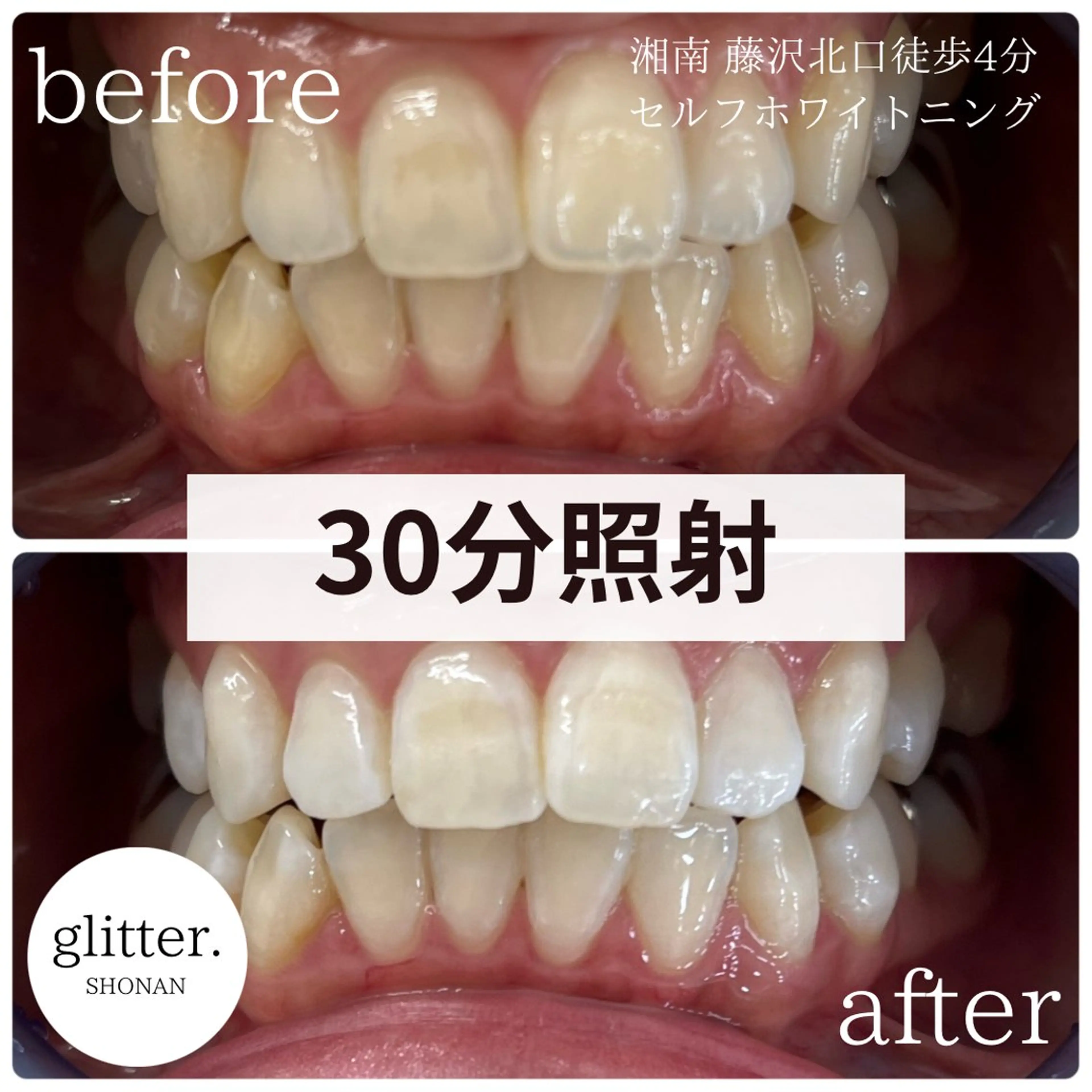 glitter.SHONAN所属・佐久間 茉弥のエステ・リラクイメージ