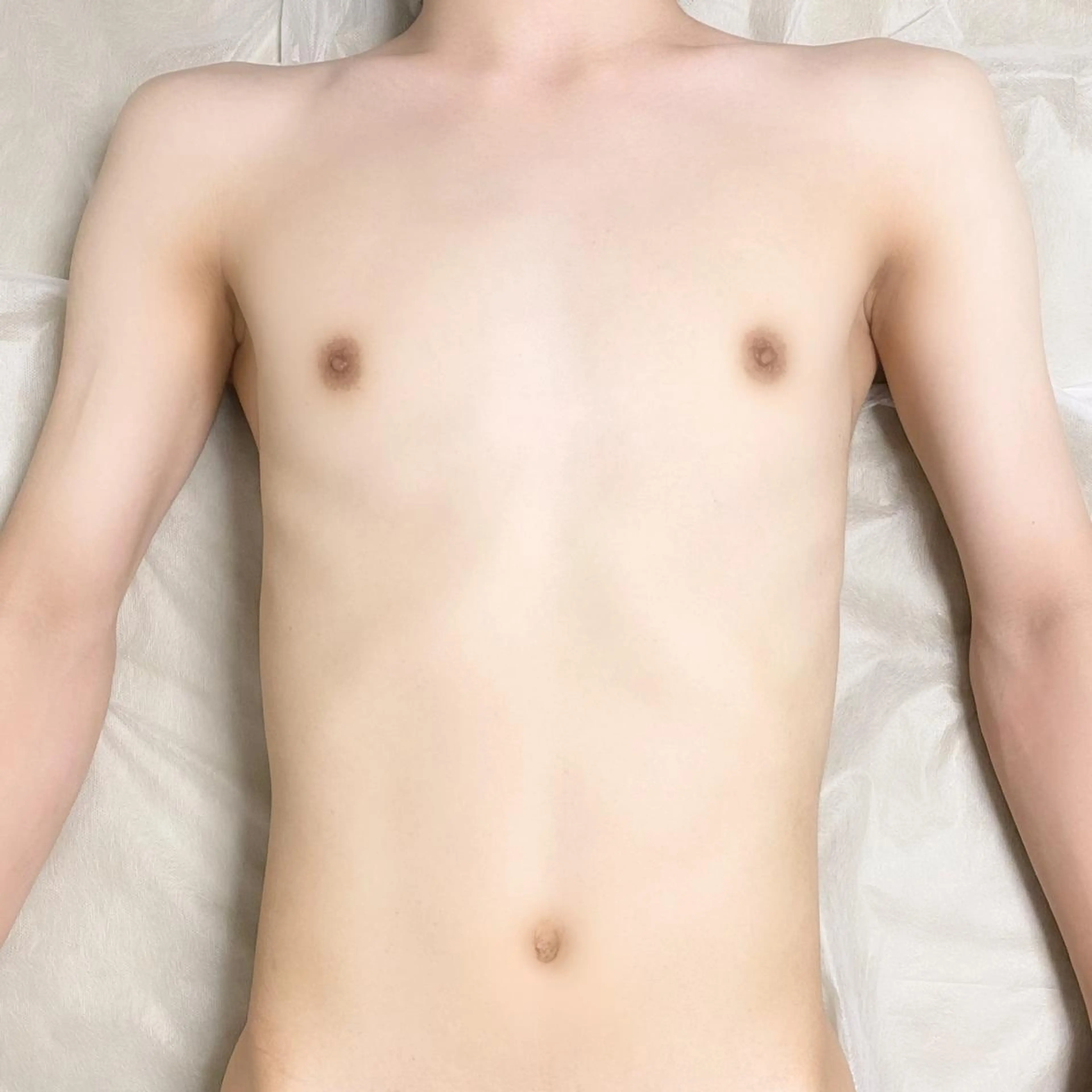 🔹メンズ胸腹脱毛体験！の写真