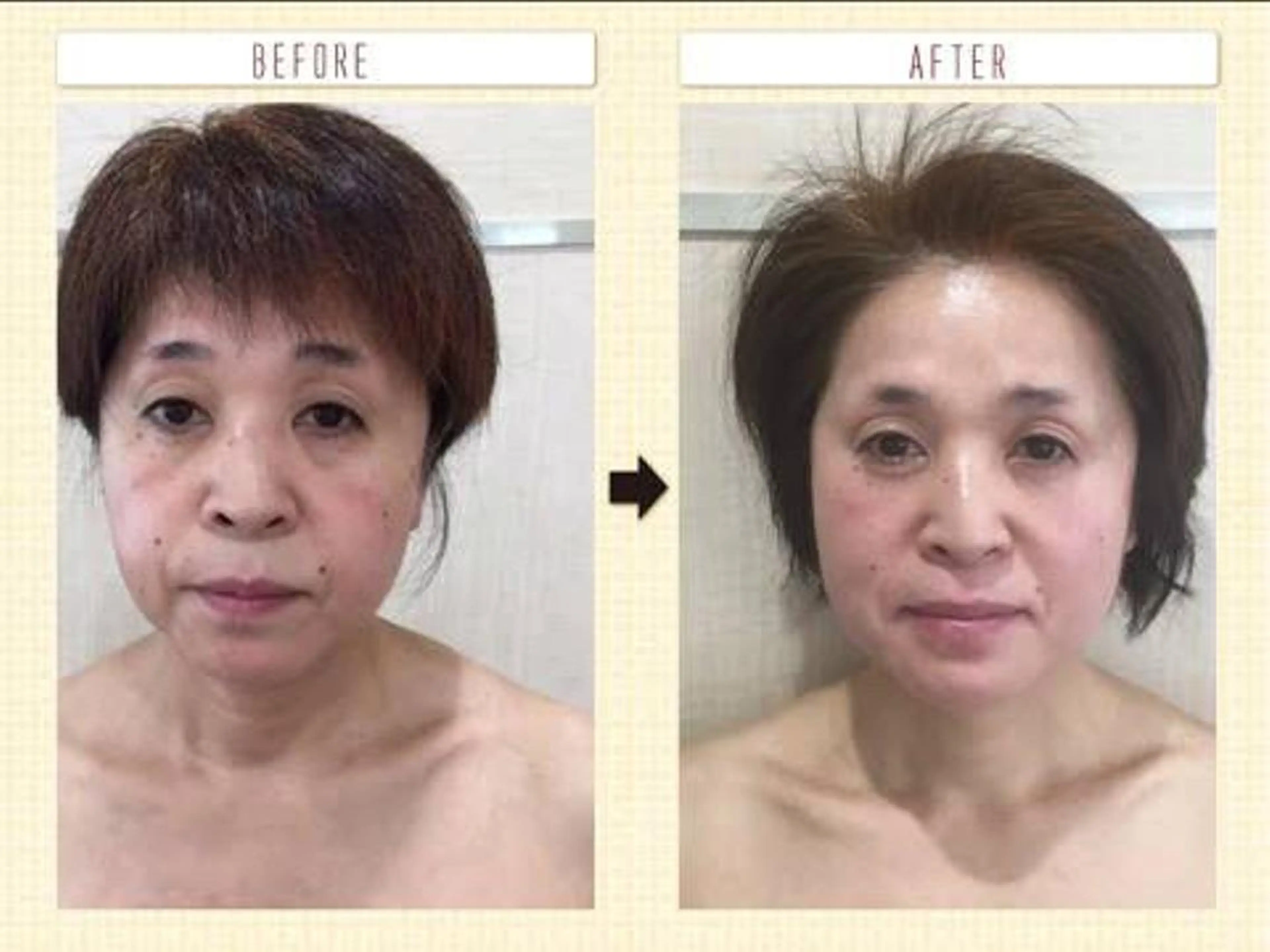 造顔フェイシャル！小じわや肌のくすみに◎の写真