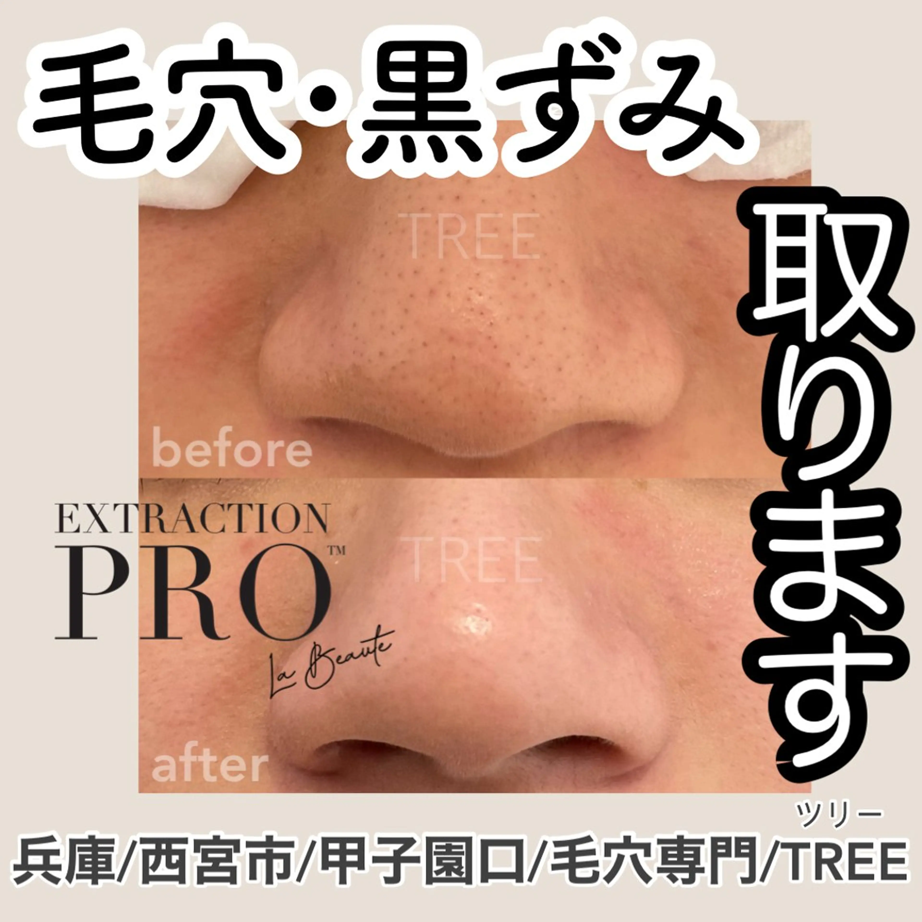 まつげ、毛穴 TREEのエステ・リラクイメージ