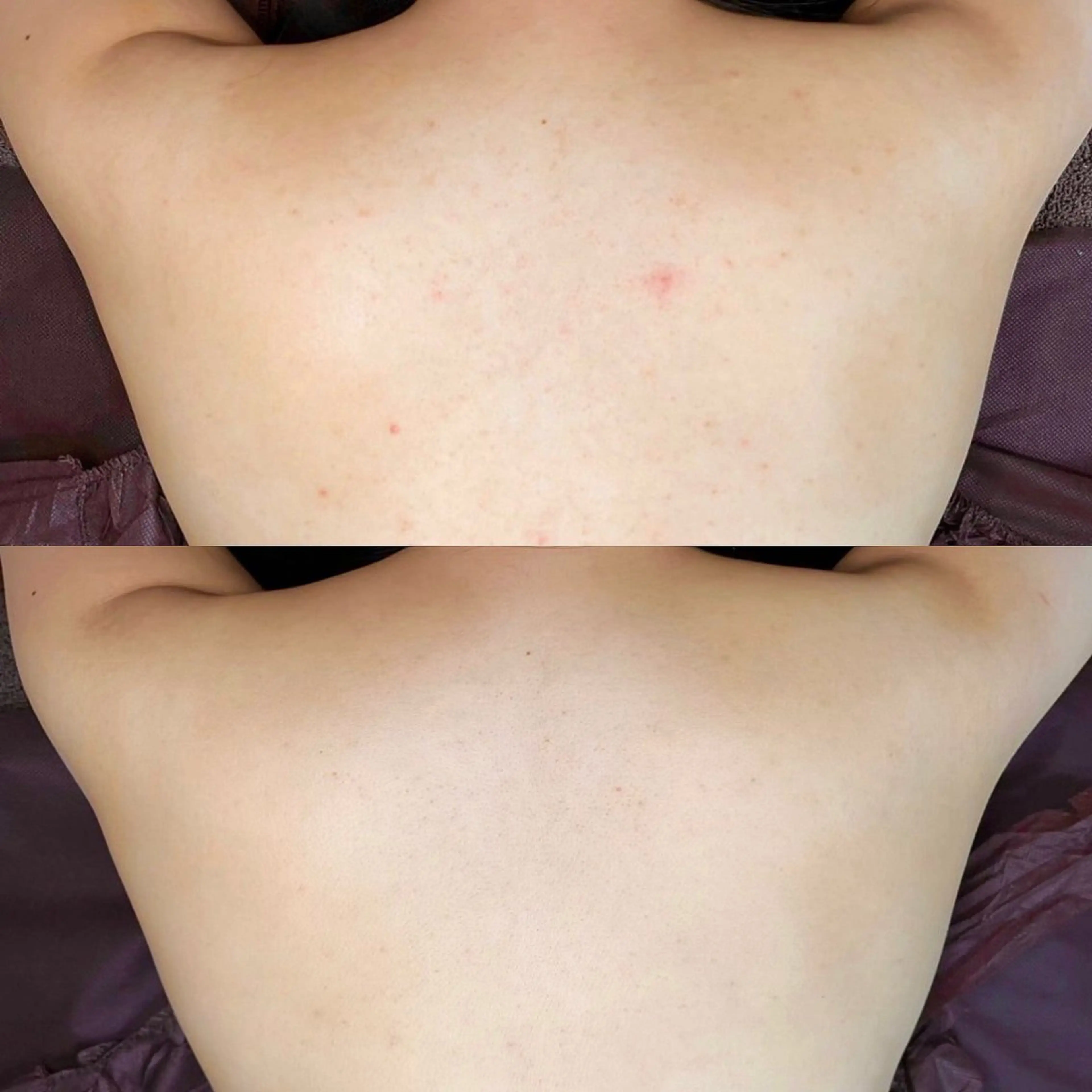 エステ EARTH coiffure beaute 小山店所属・EARTH 小山店 shimaのエステ・リラクイメージ