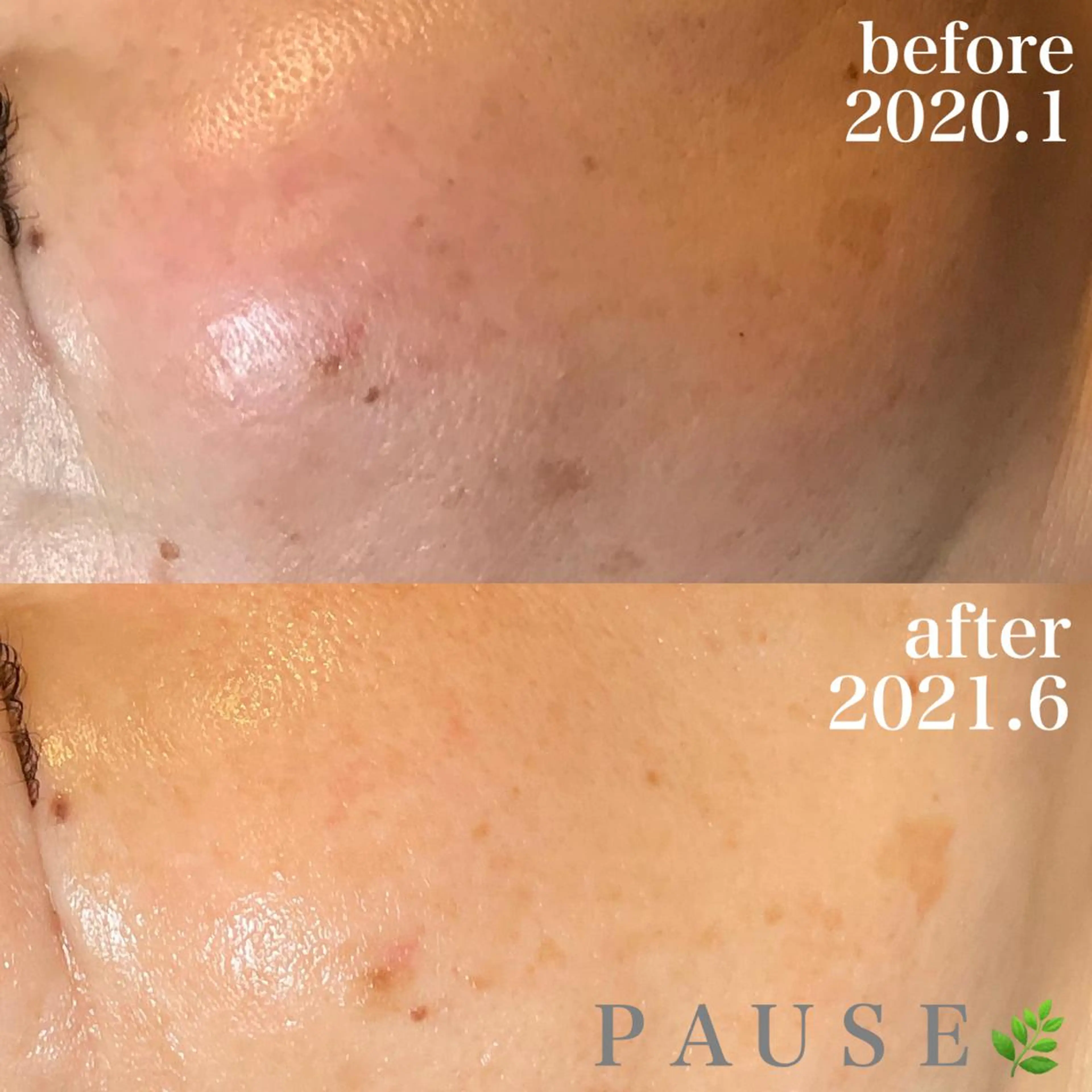 エステ リラク 浜野 恵美のエステ・リラクイメージ