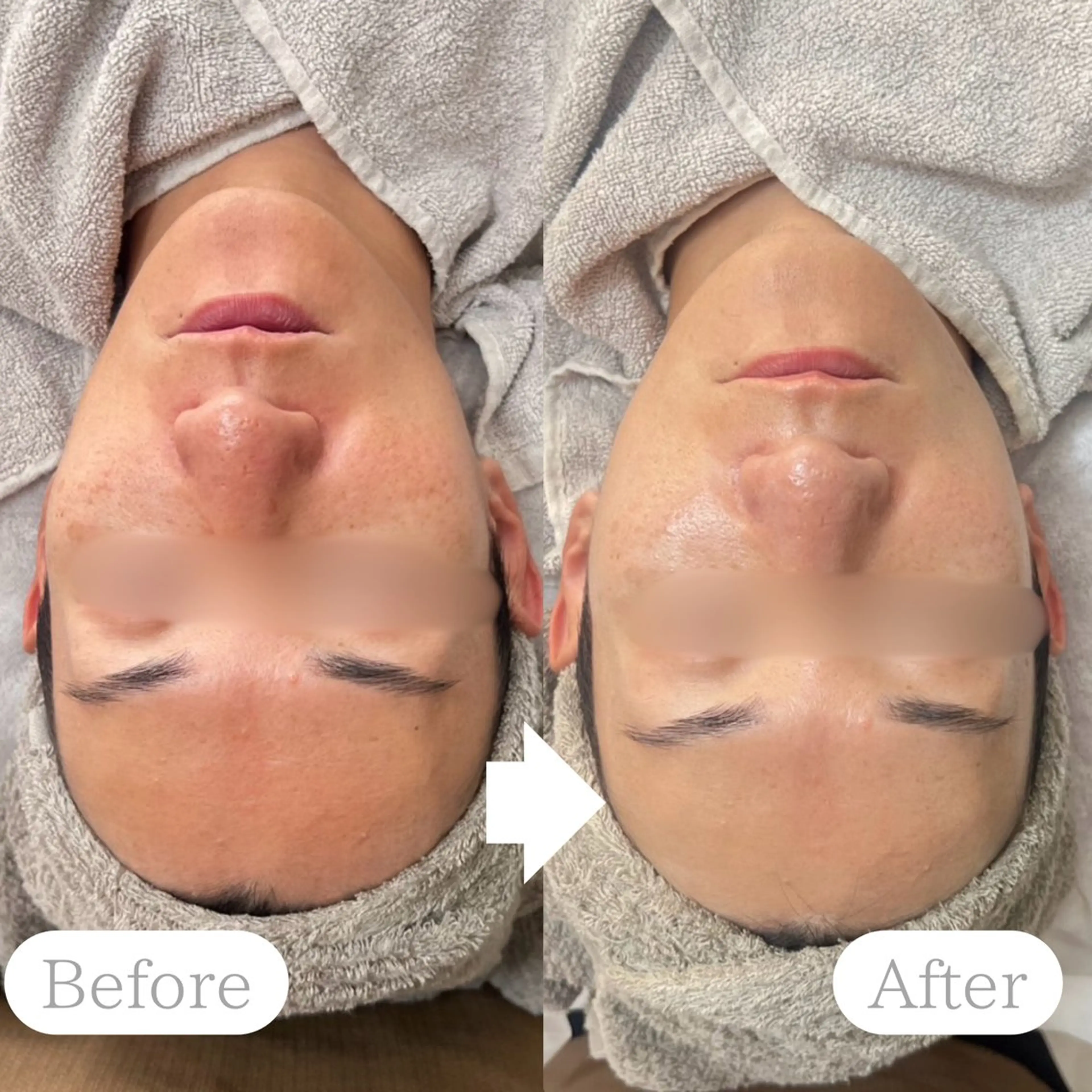 エステ ホワイトニング×肌質 改善~elエル~のその他イメージ