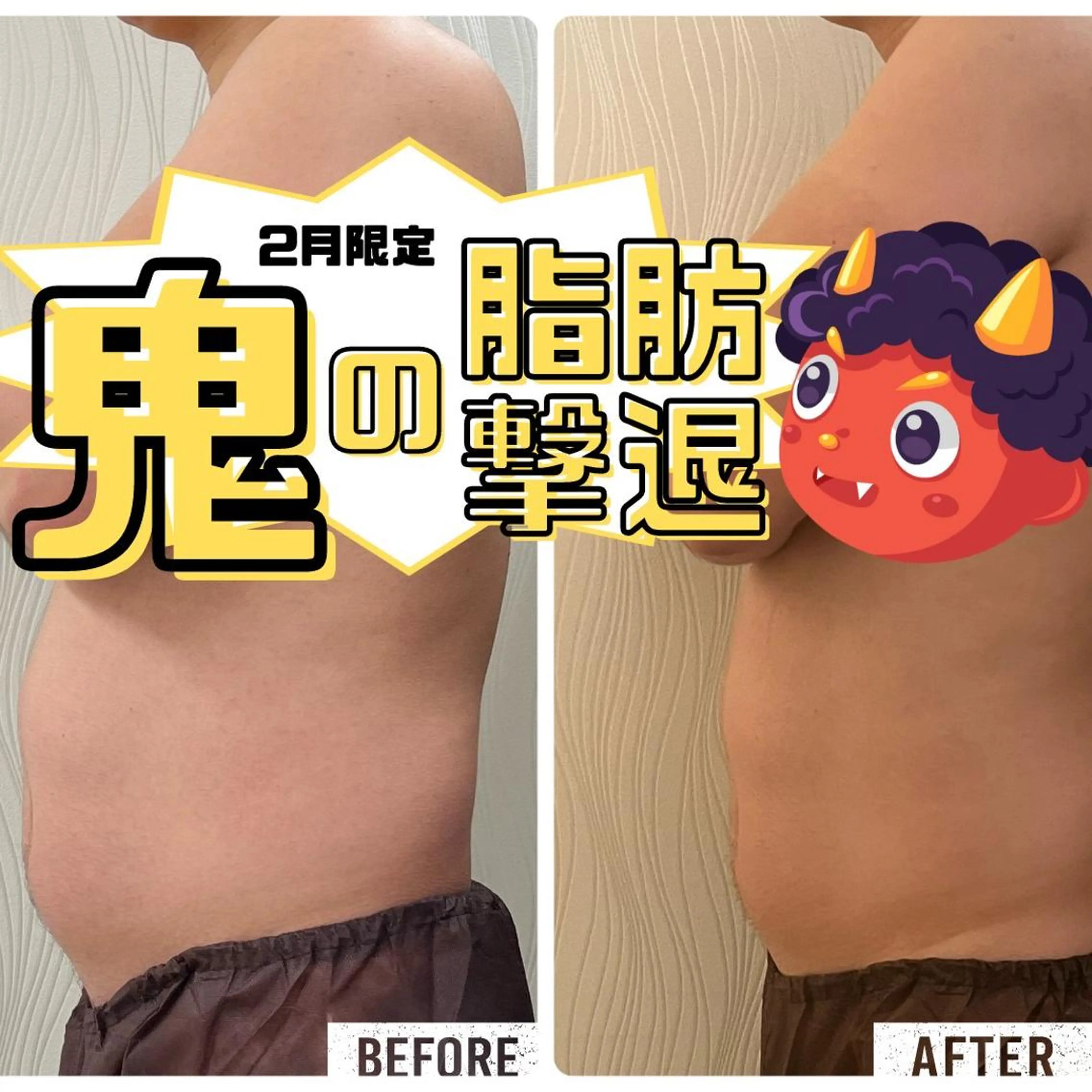 エステ 次世代痩身 人生最後のダイエットのエステ・リラクイメージ