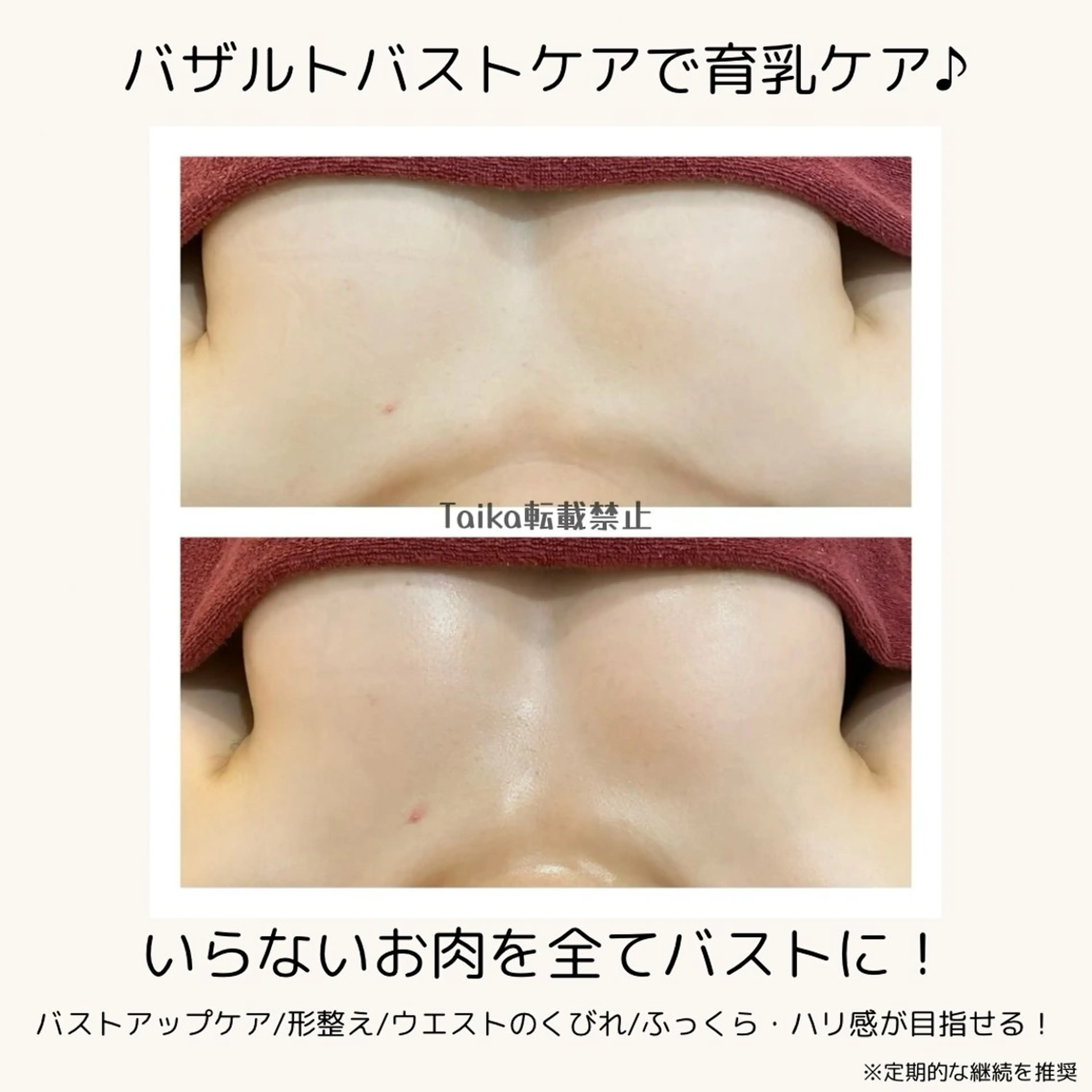 いらないお肉を全てバストに！上向き美乳リフトバストコースの写真