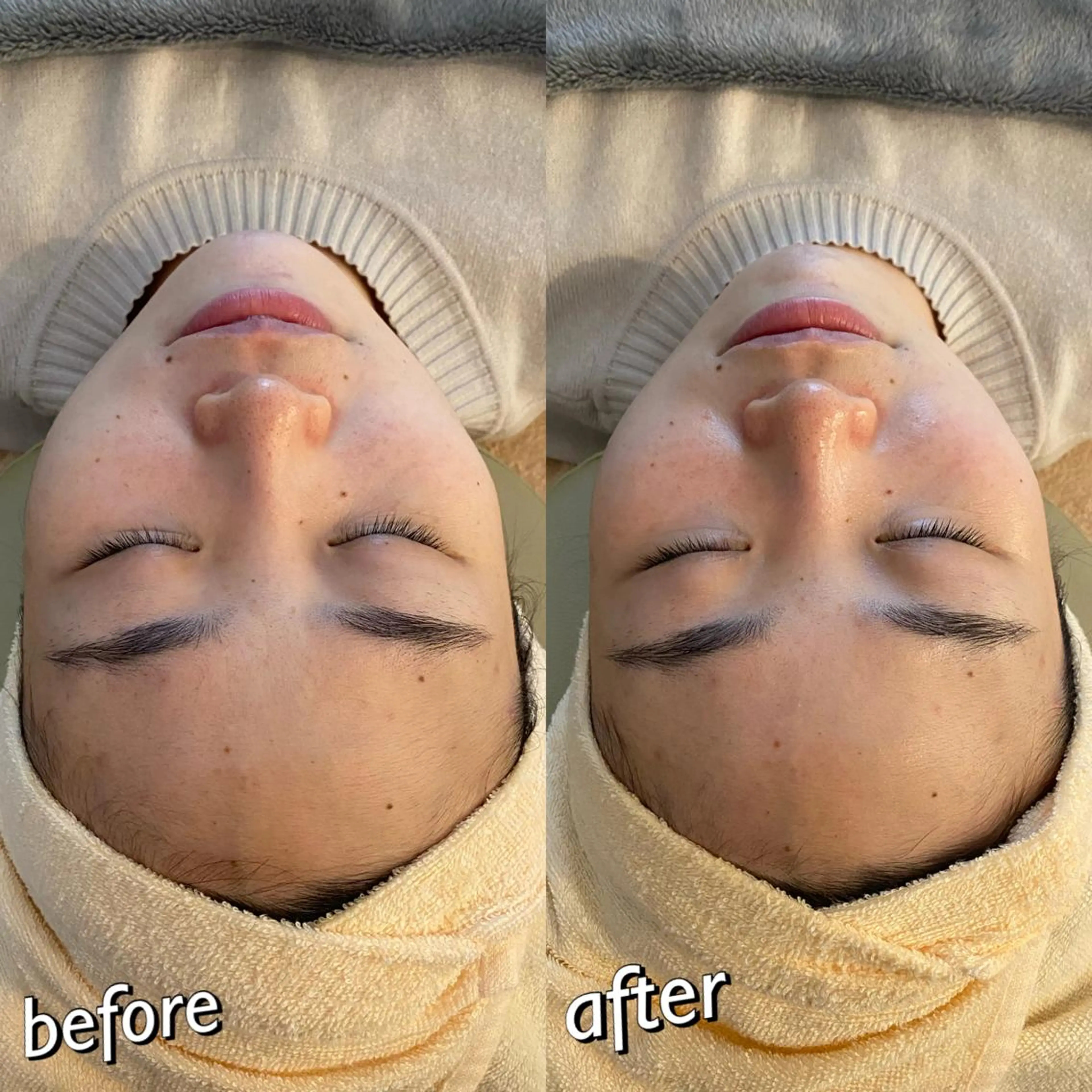 うなじ脱毛/美肌脱毛 LABELのエステ・リラクイメージ