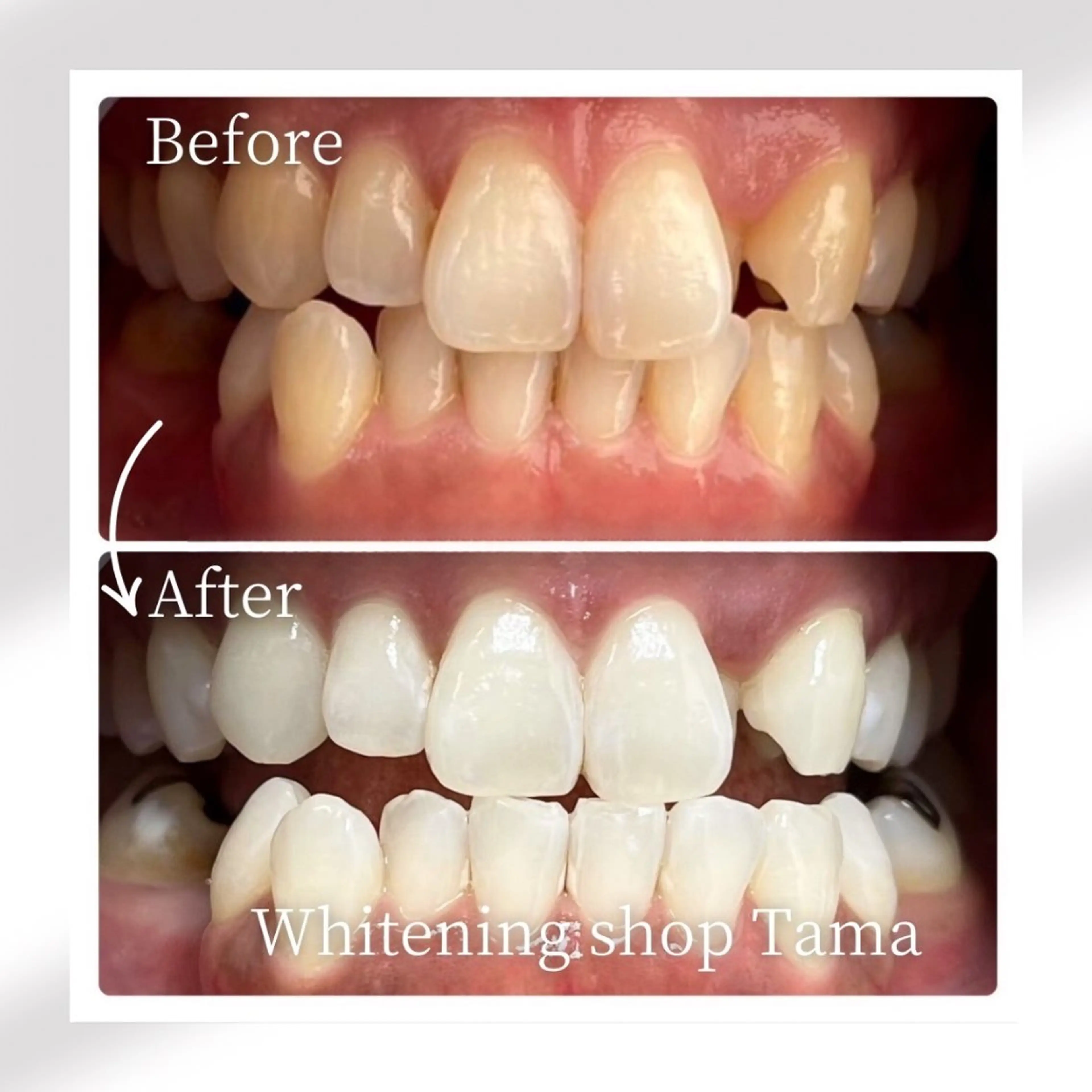 メンズ ホワイトニング ショップ多摩店のその他イメージ