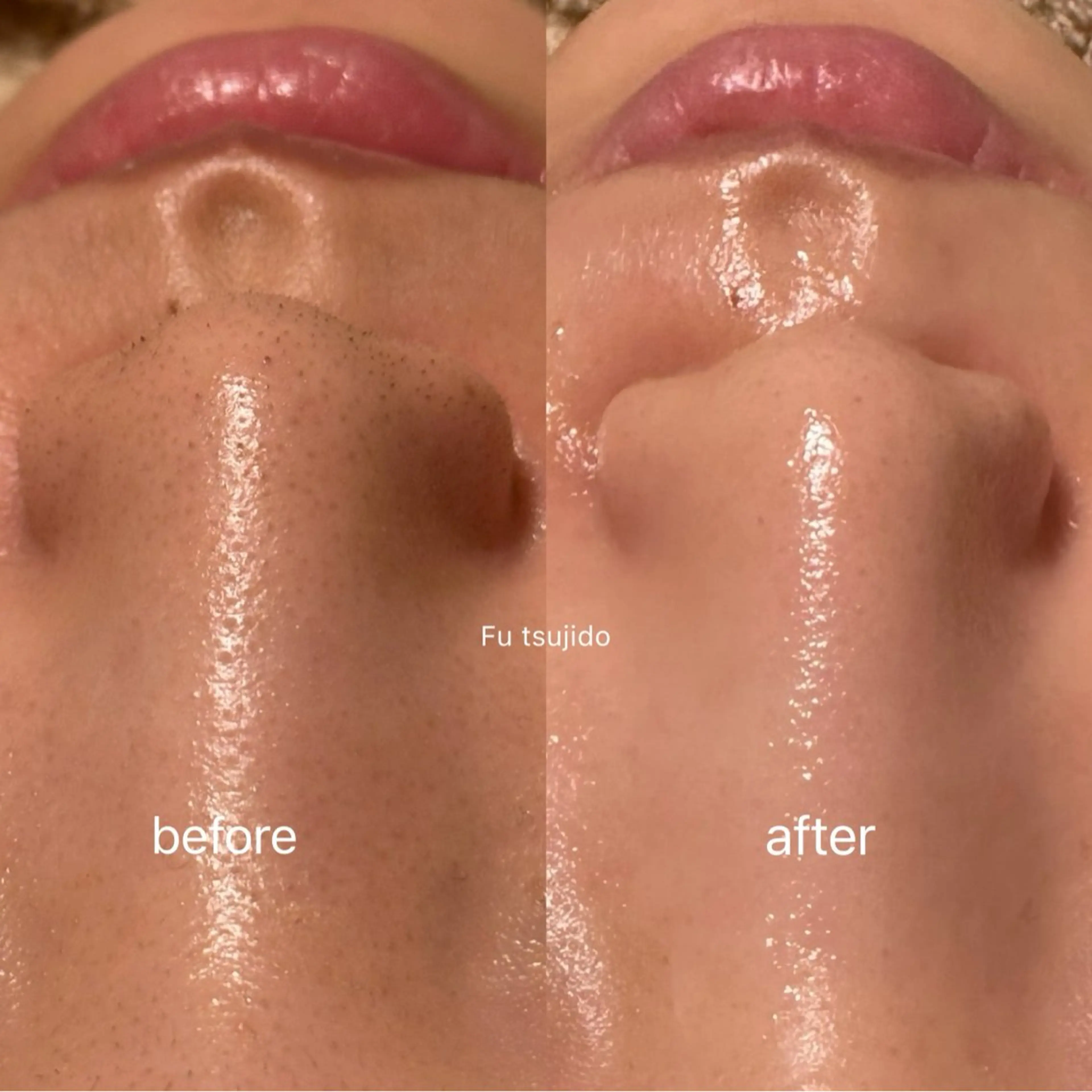 メンズ キッズ ネイル その他 Fu 辻堂店のネイルデザイン