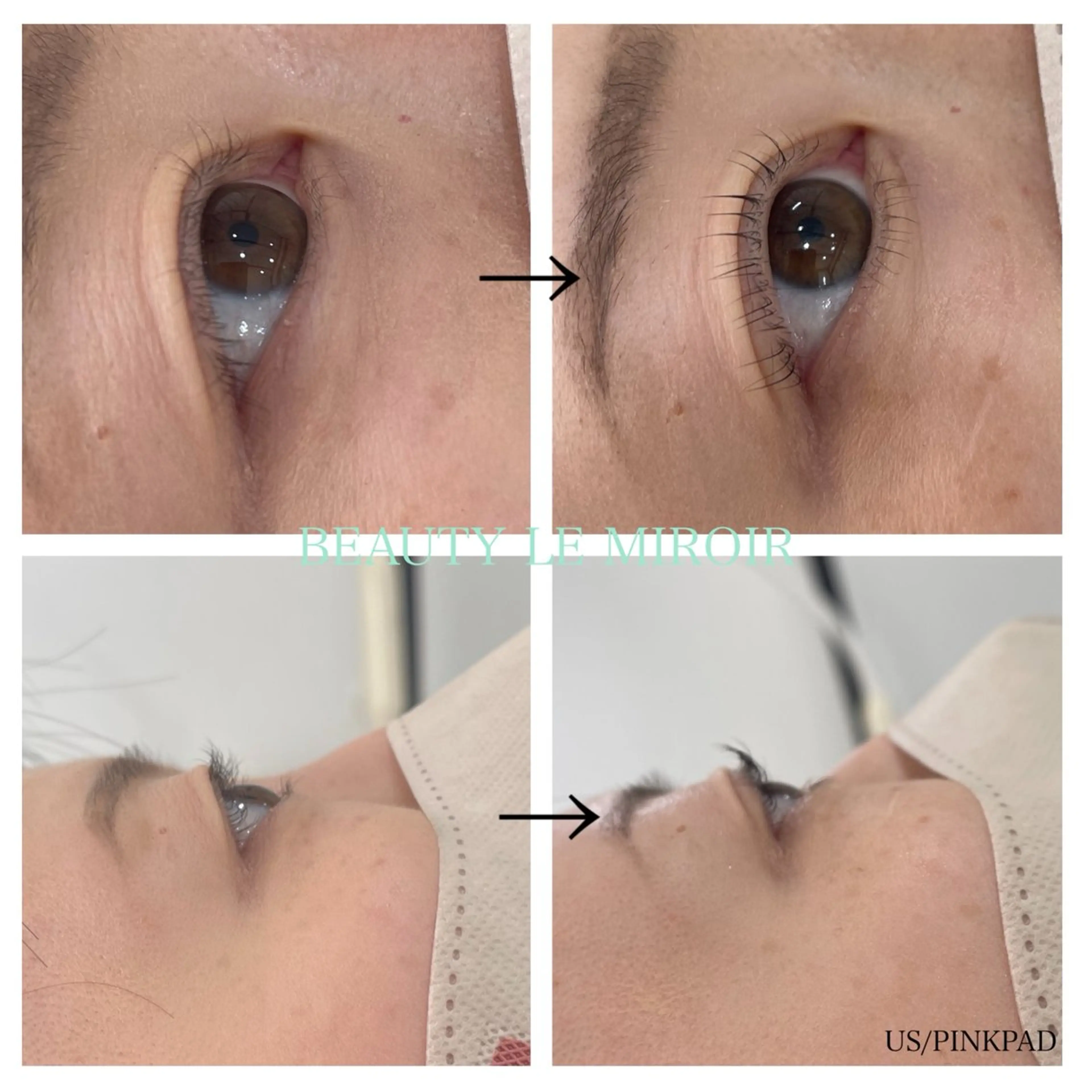 マツエク・マツパ 下まつげエクステ ビューティー ミロワールのエステ・リラクイメージ