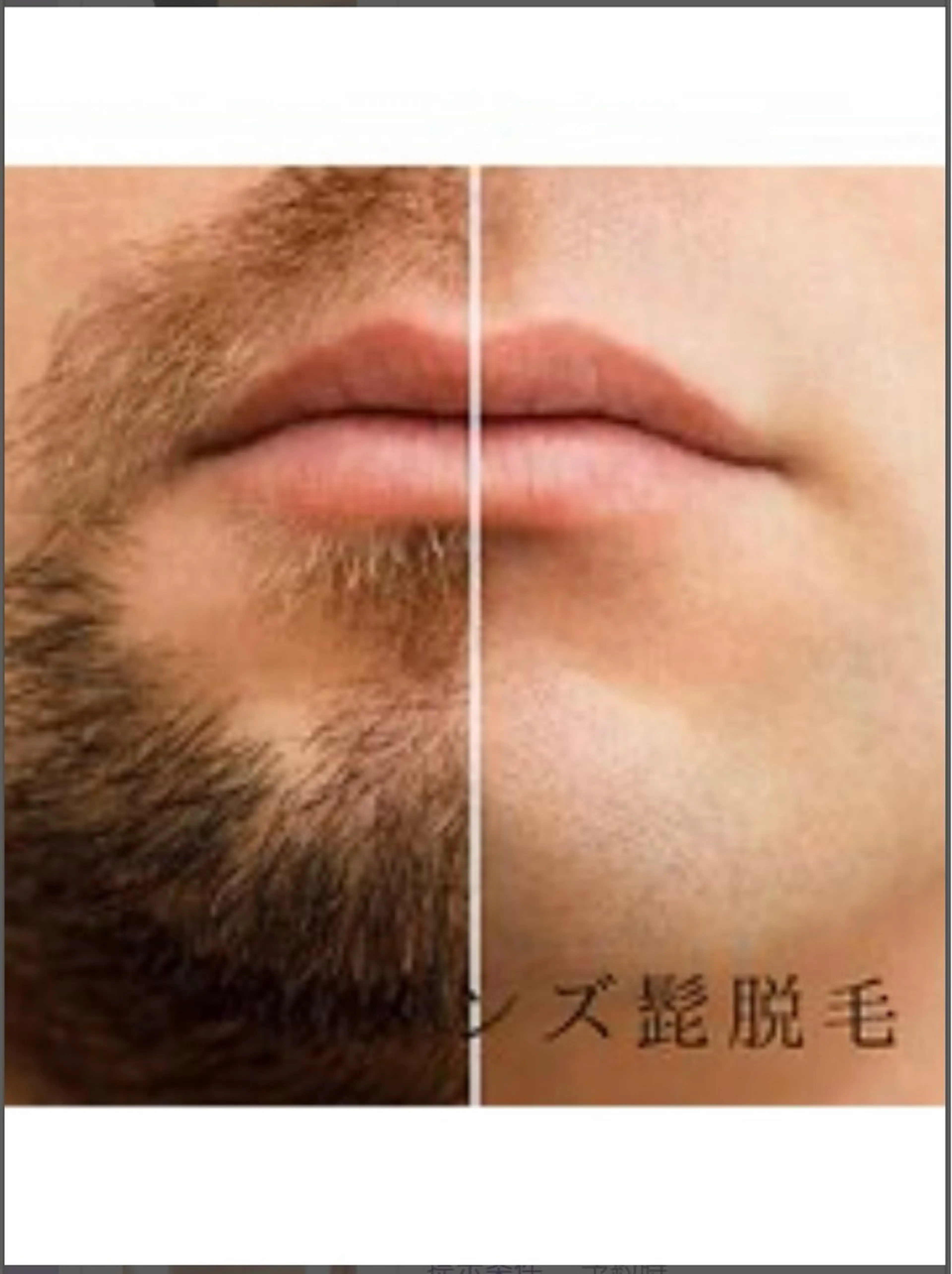 メンズ 毛の専門店BALDER.所属・men'sのトータル 美容👨✨ヒロのエステ・リラクイメージ