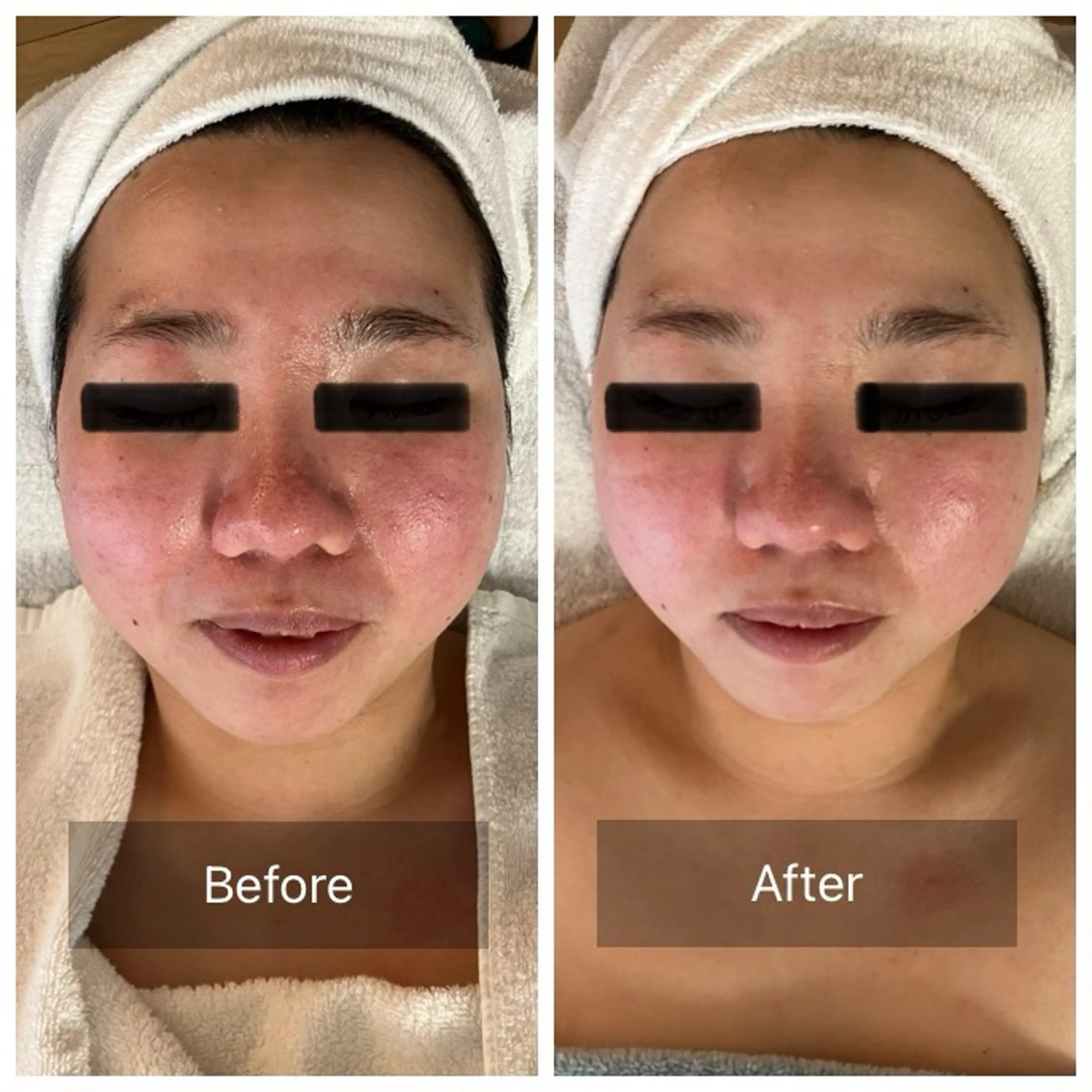 エステ エステサロン Minkのエステ・リラクイメージ