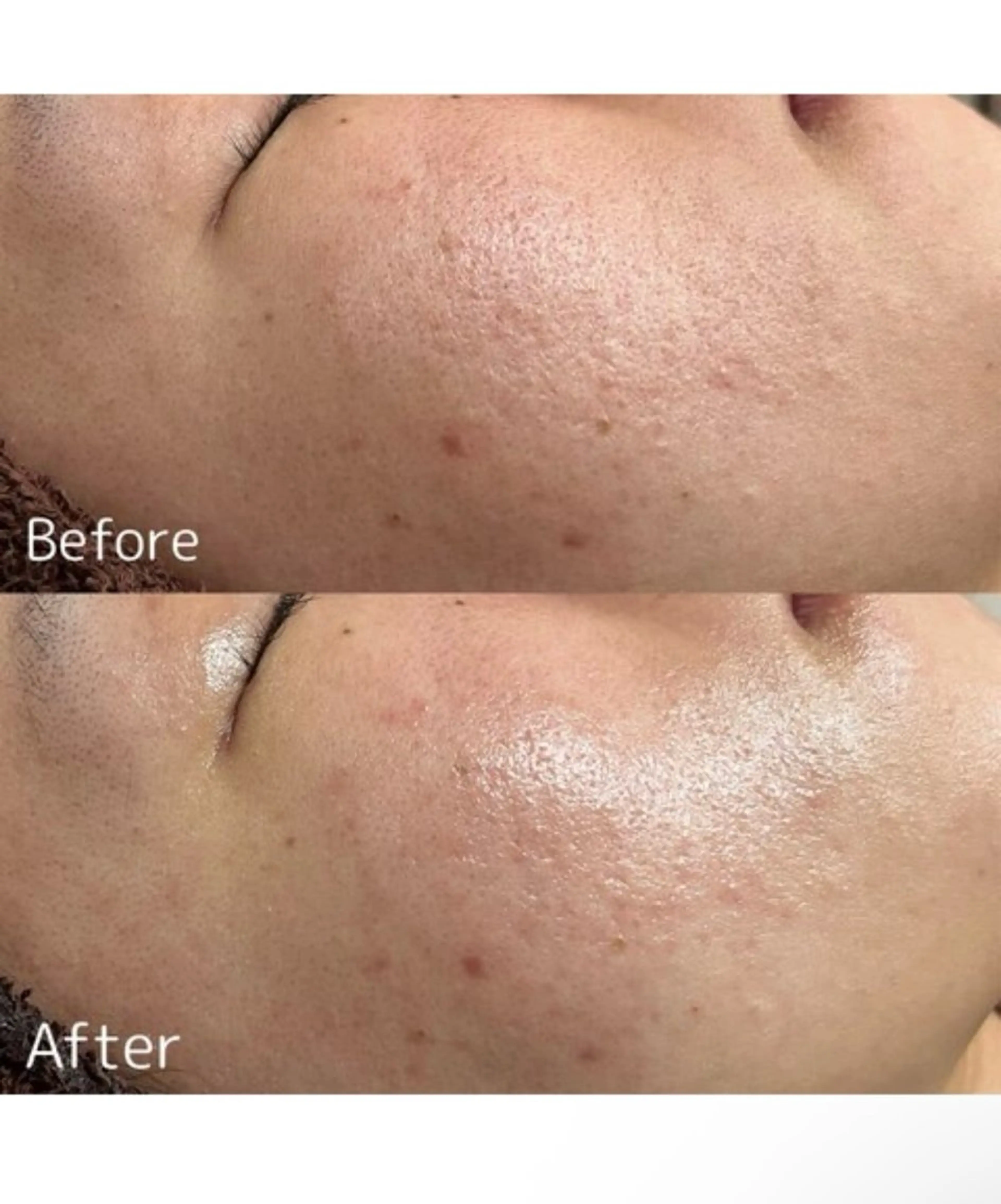 MINOA所属・MINOA 井上🌷のエステ・リラクイメージ