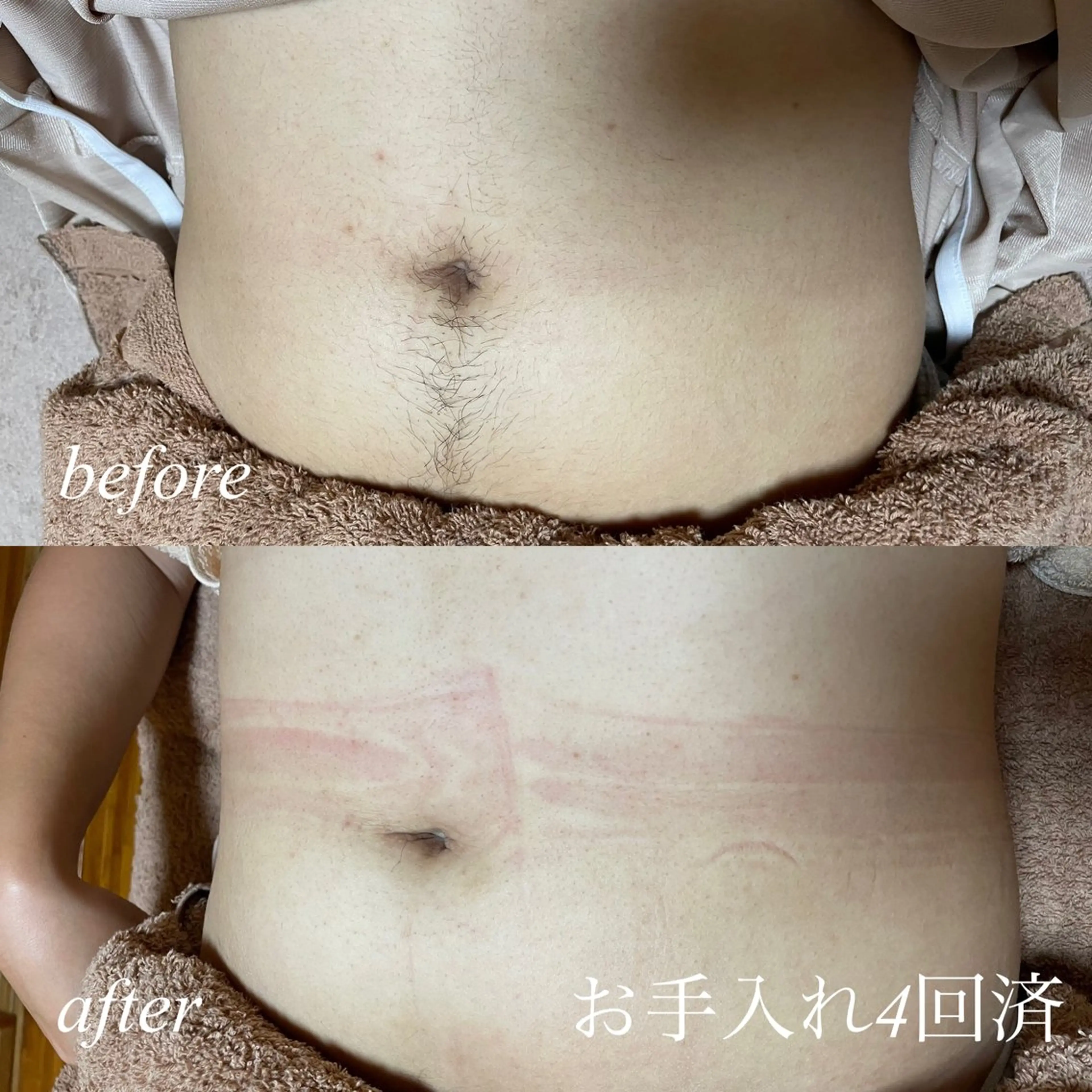 脱毛 プライベートサロンmuku所属・プライベートサロン mukuのエステ・リラクイメージ